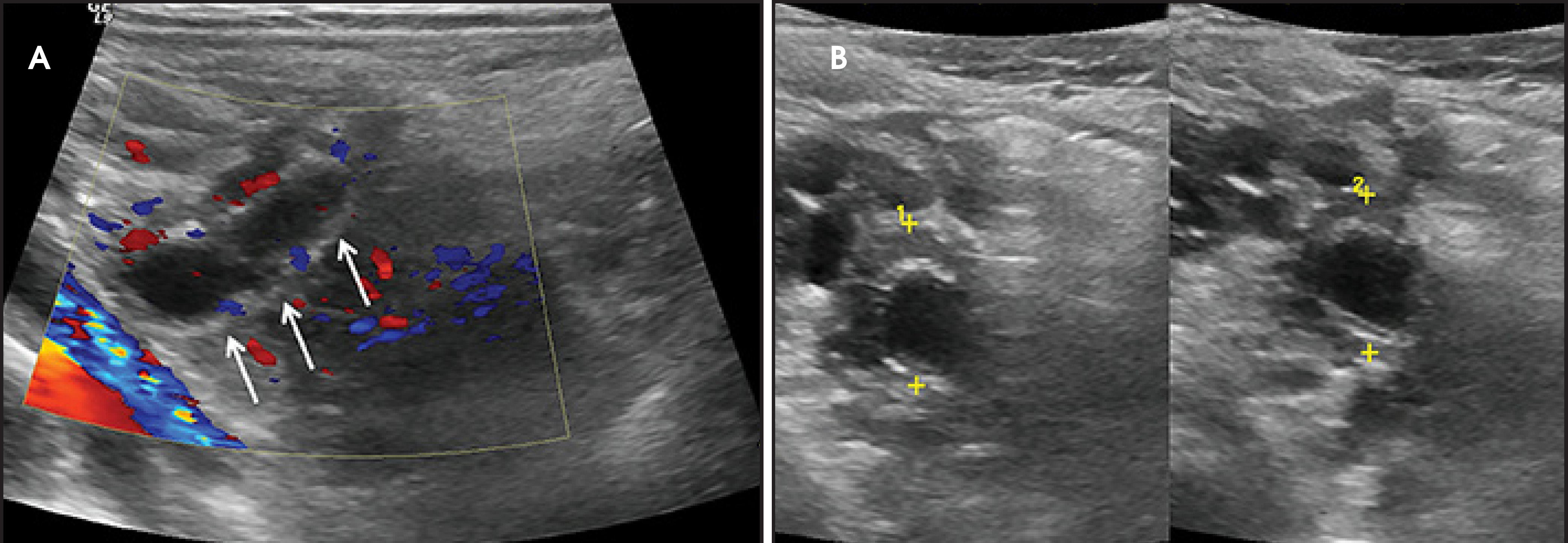 FIGURE 6.