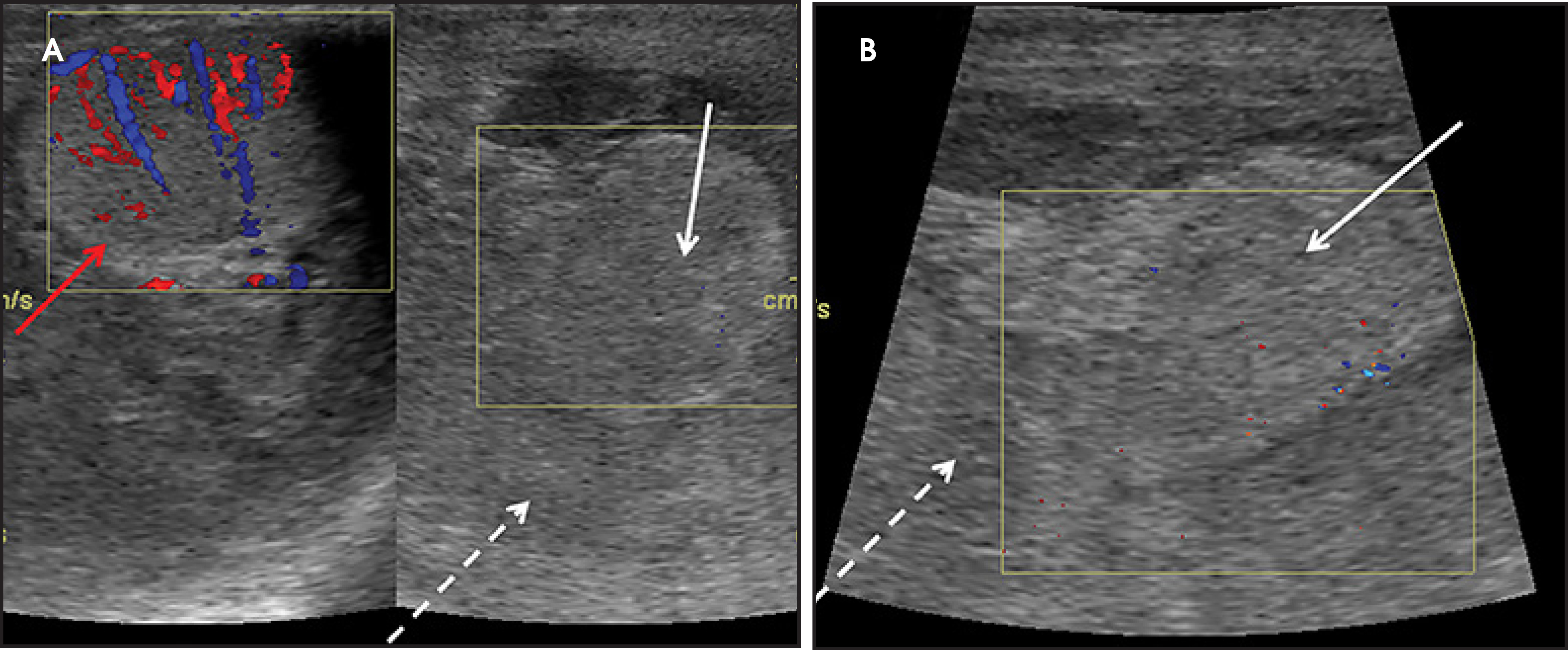 FIGURE 11.