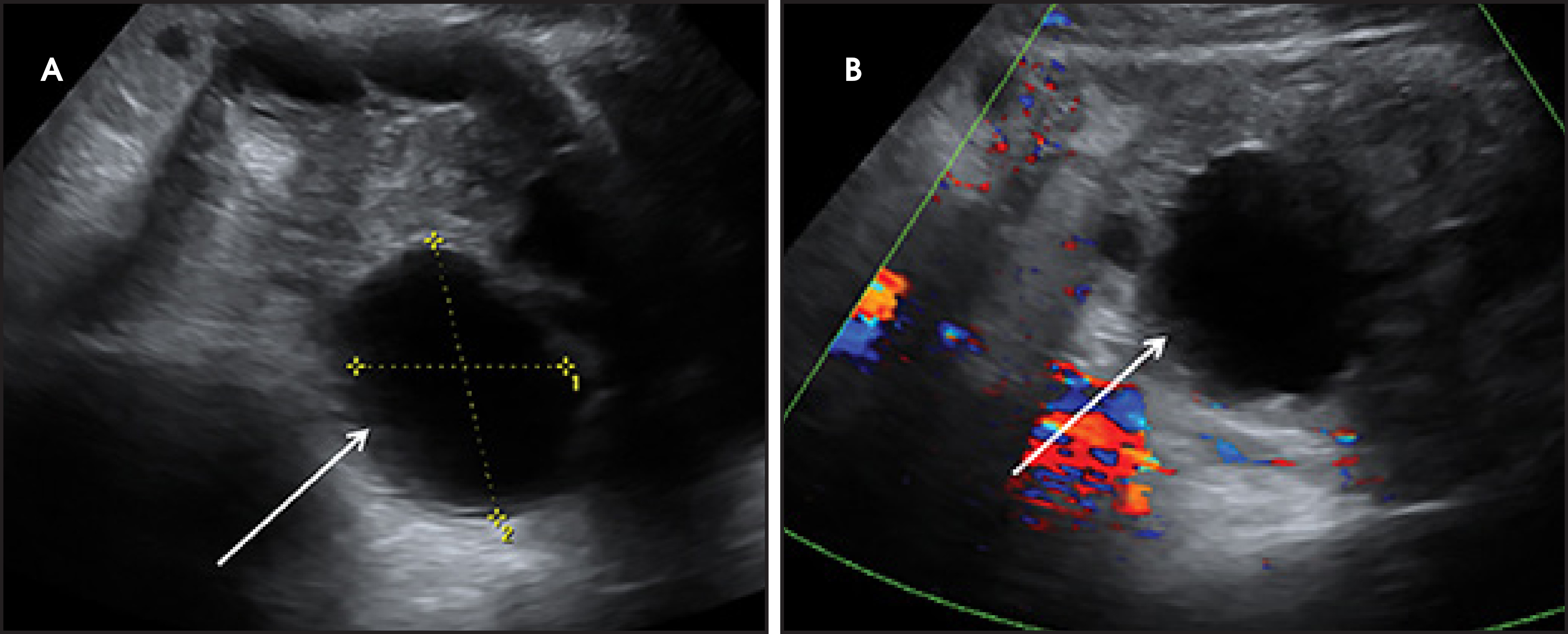 FIGURE 13.