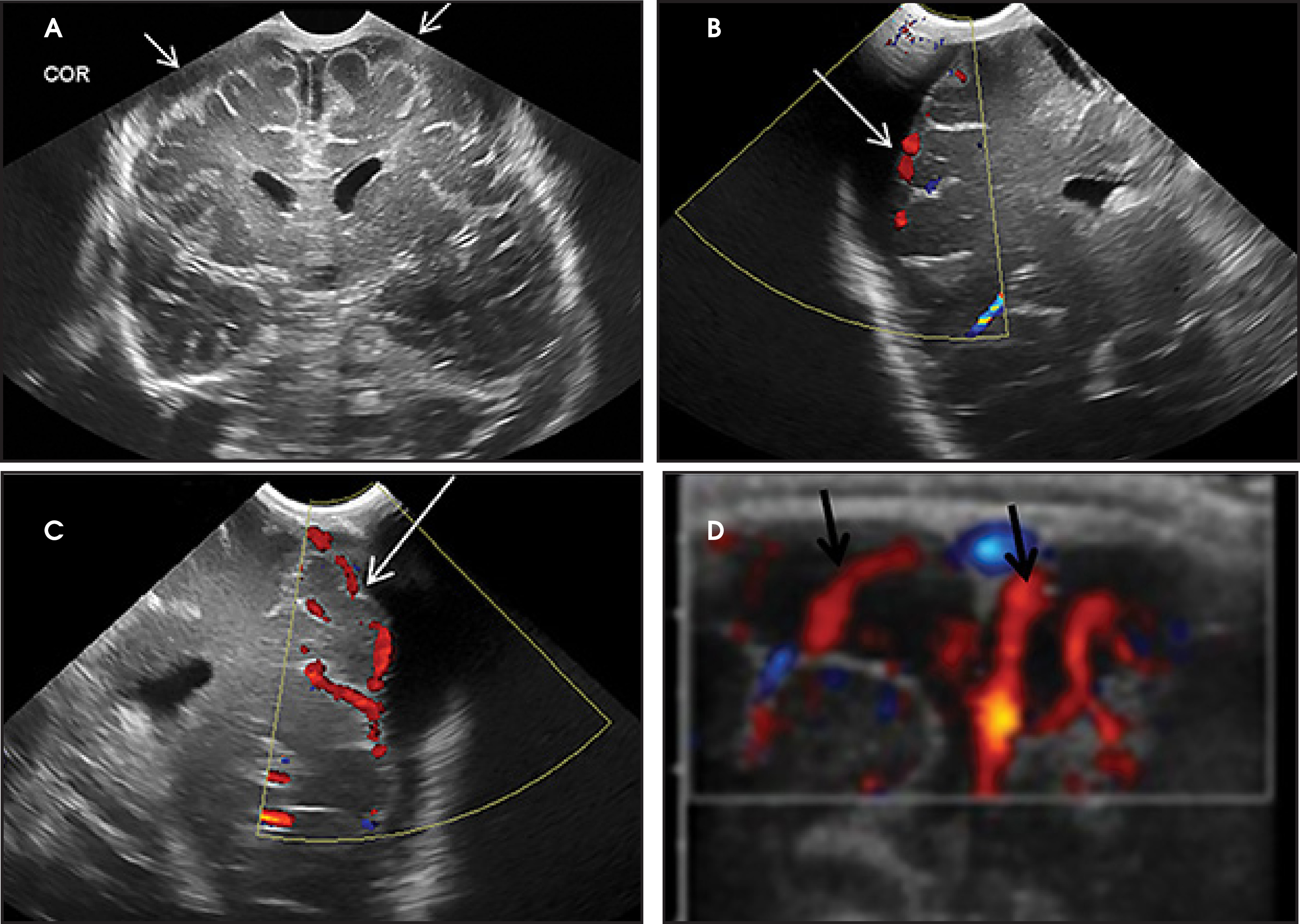 FIGURE 16.