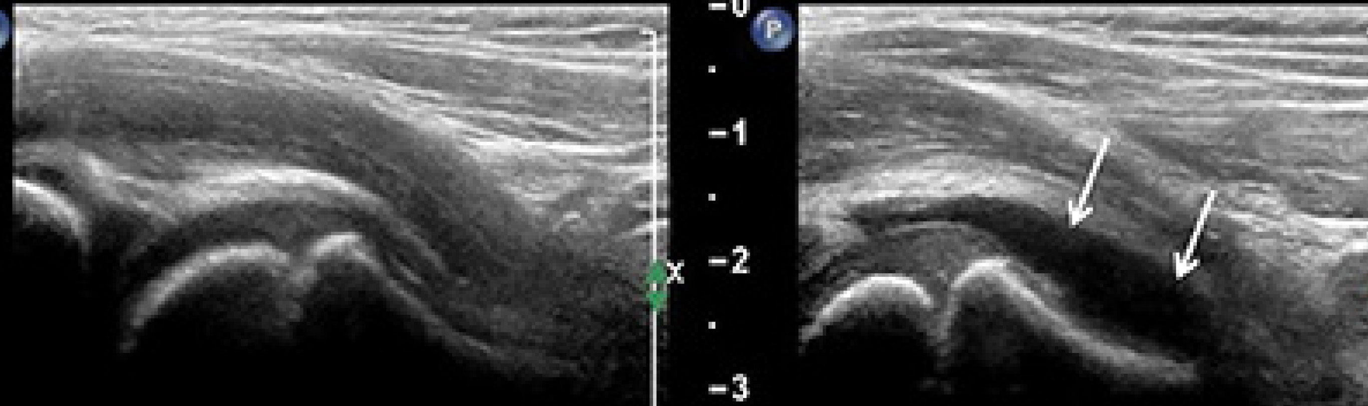 FIGURE 17.