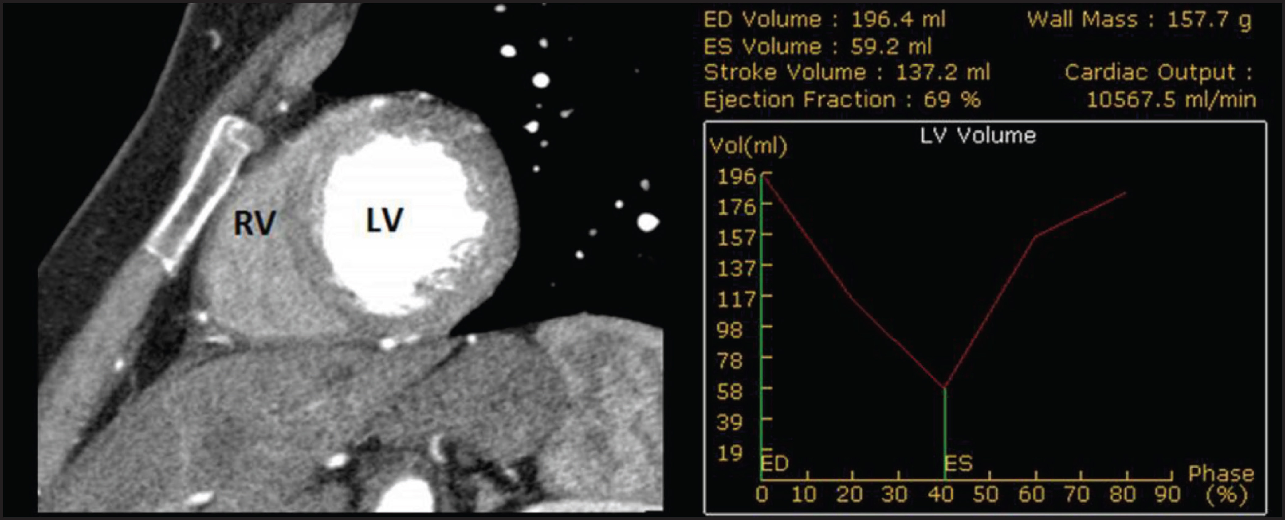 FIGURE 4.