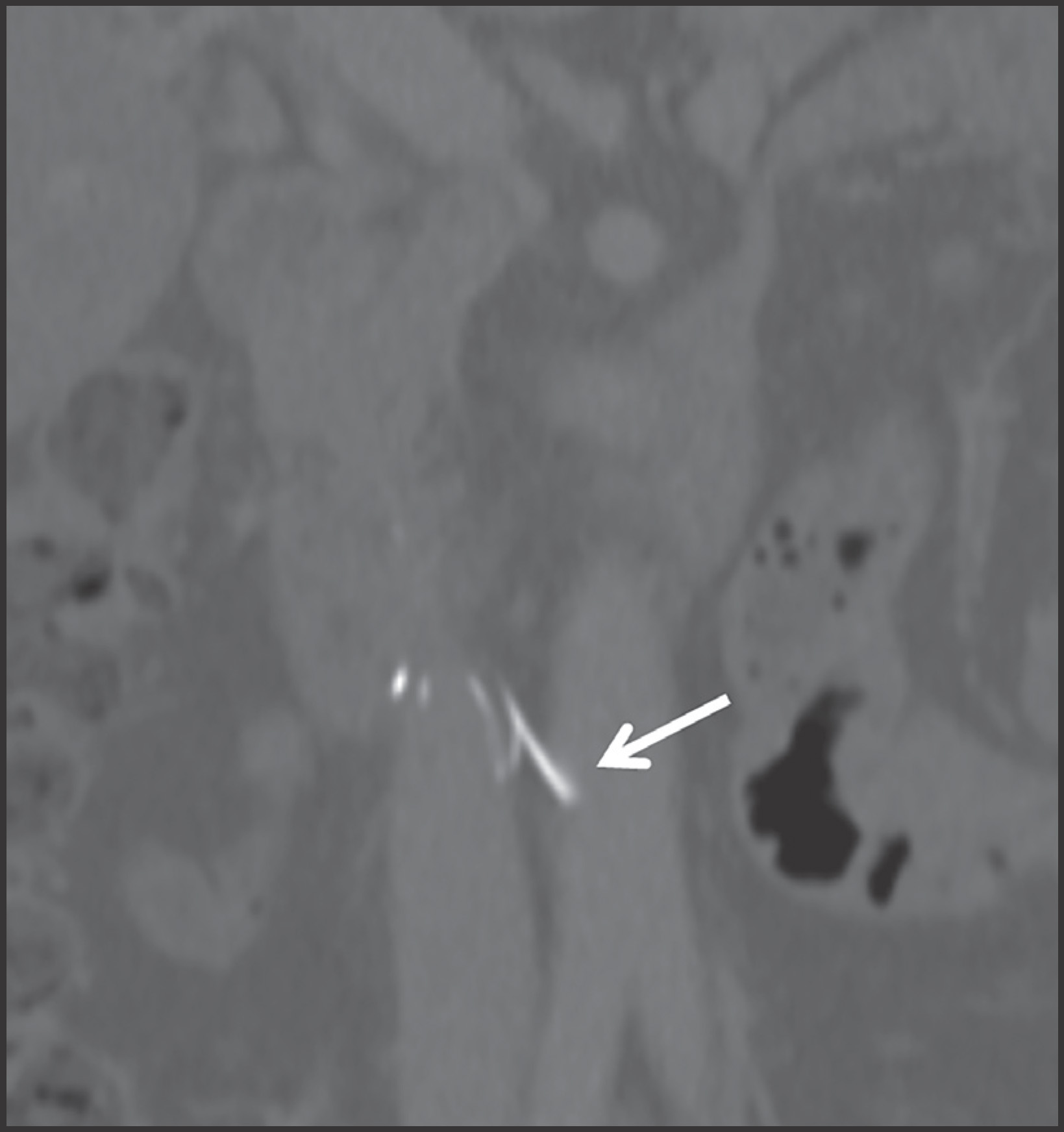 FIGURE 4.