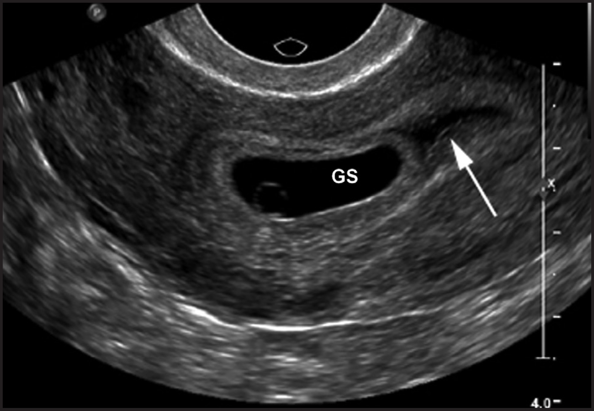 FIGURE 7.