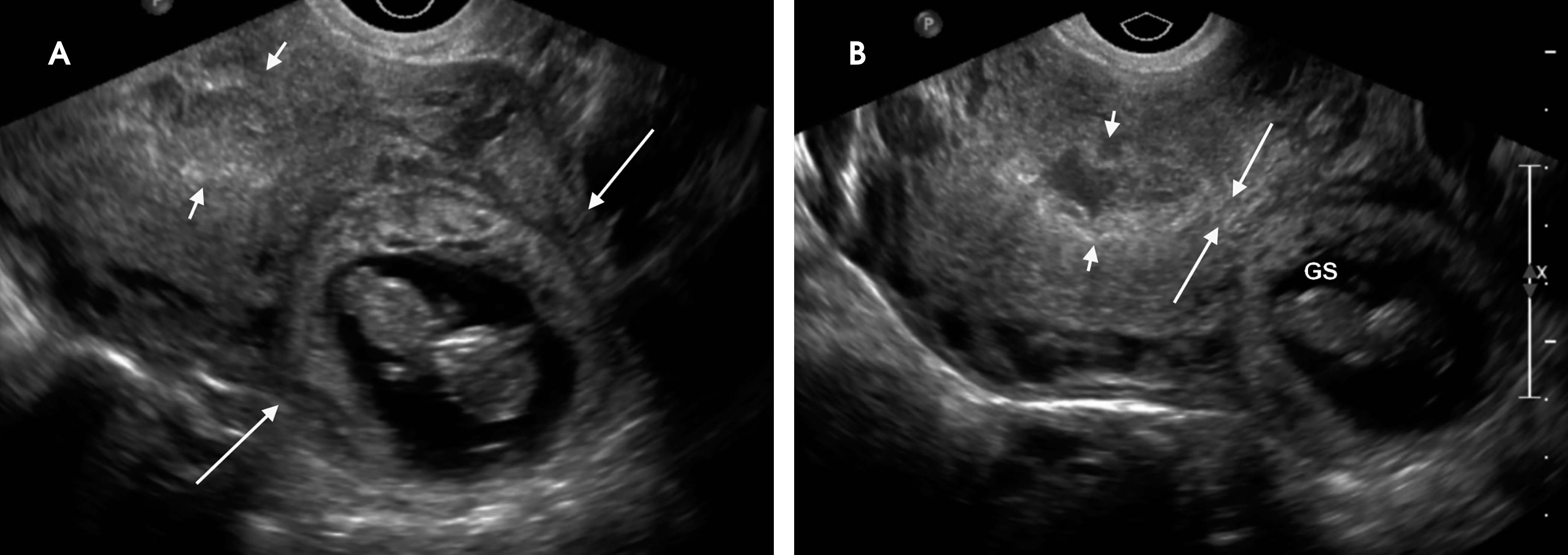 FIGURE 10.