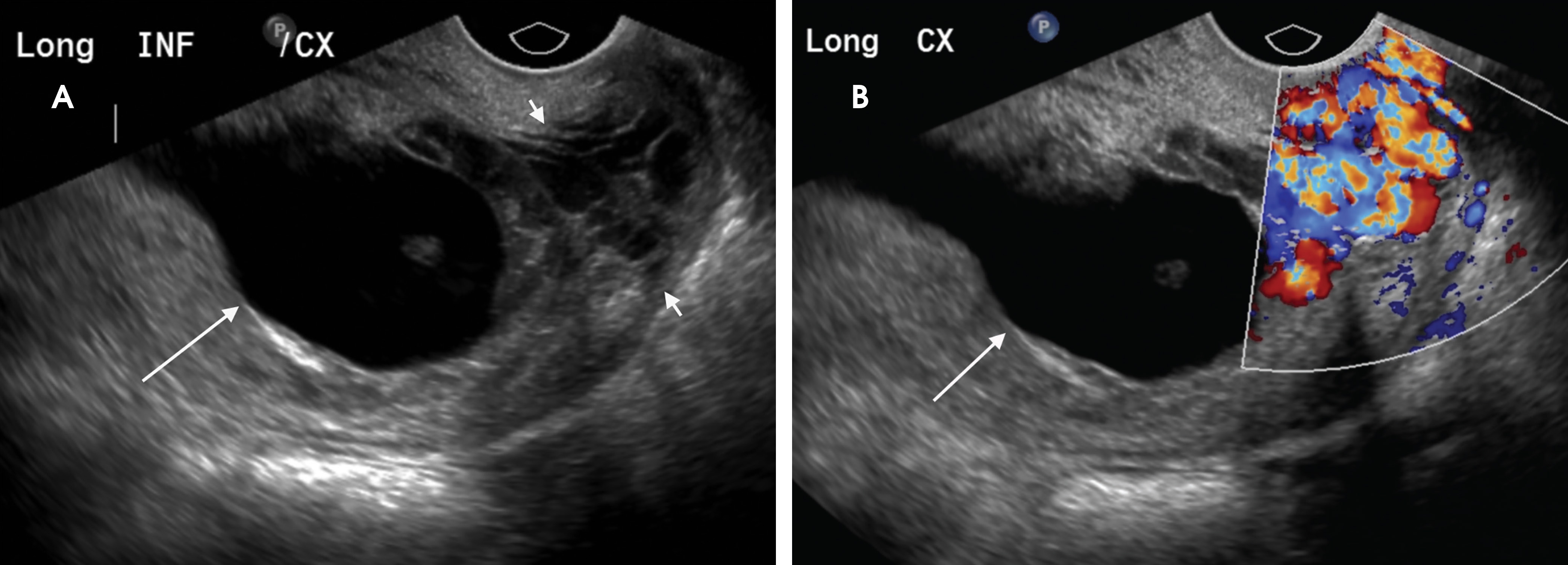 FIGURE 11.