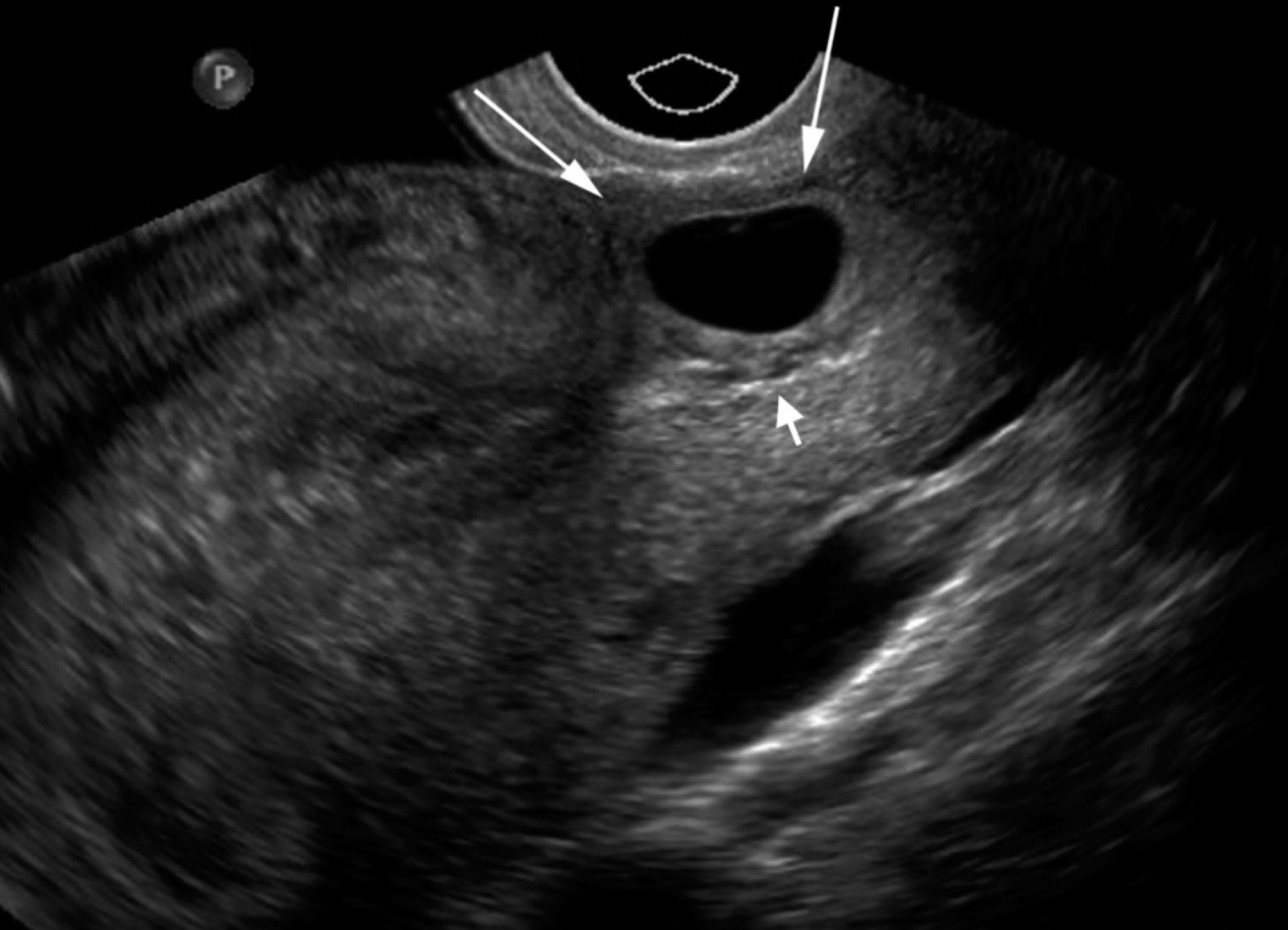 FIGURE 13.