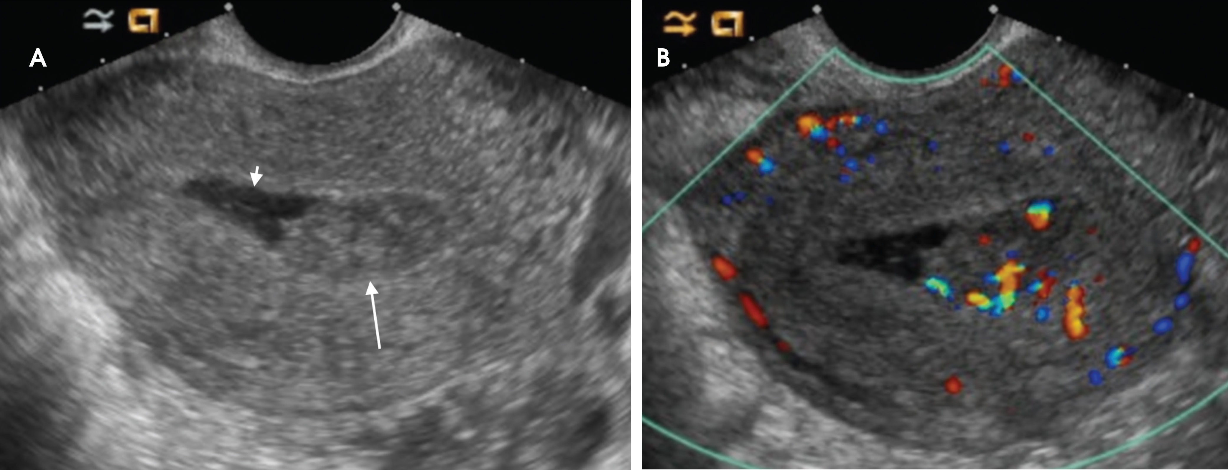 FIGURE 14.