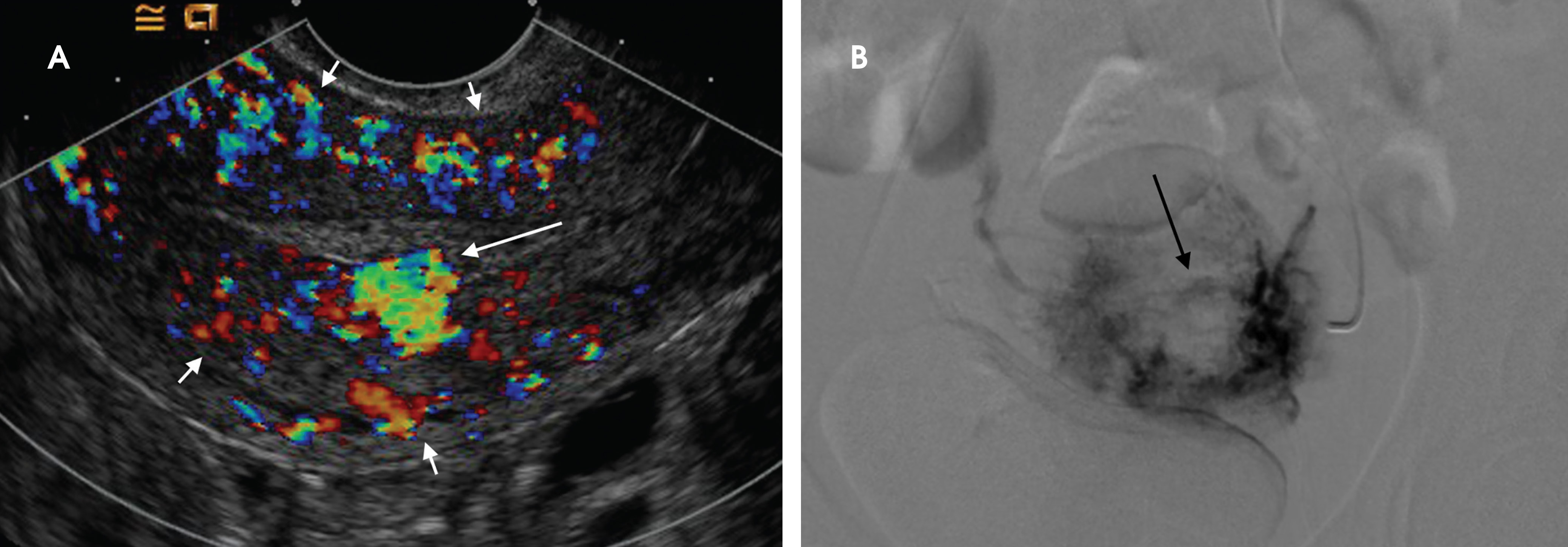 FIGURE 15.