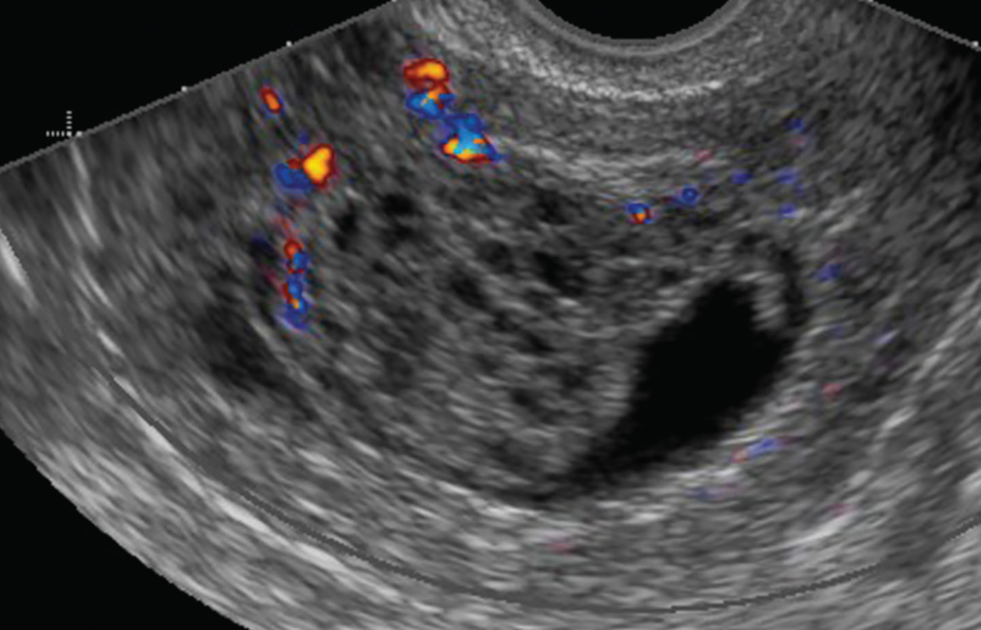 FIGURE 16.