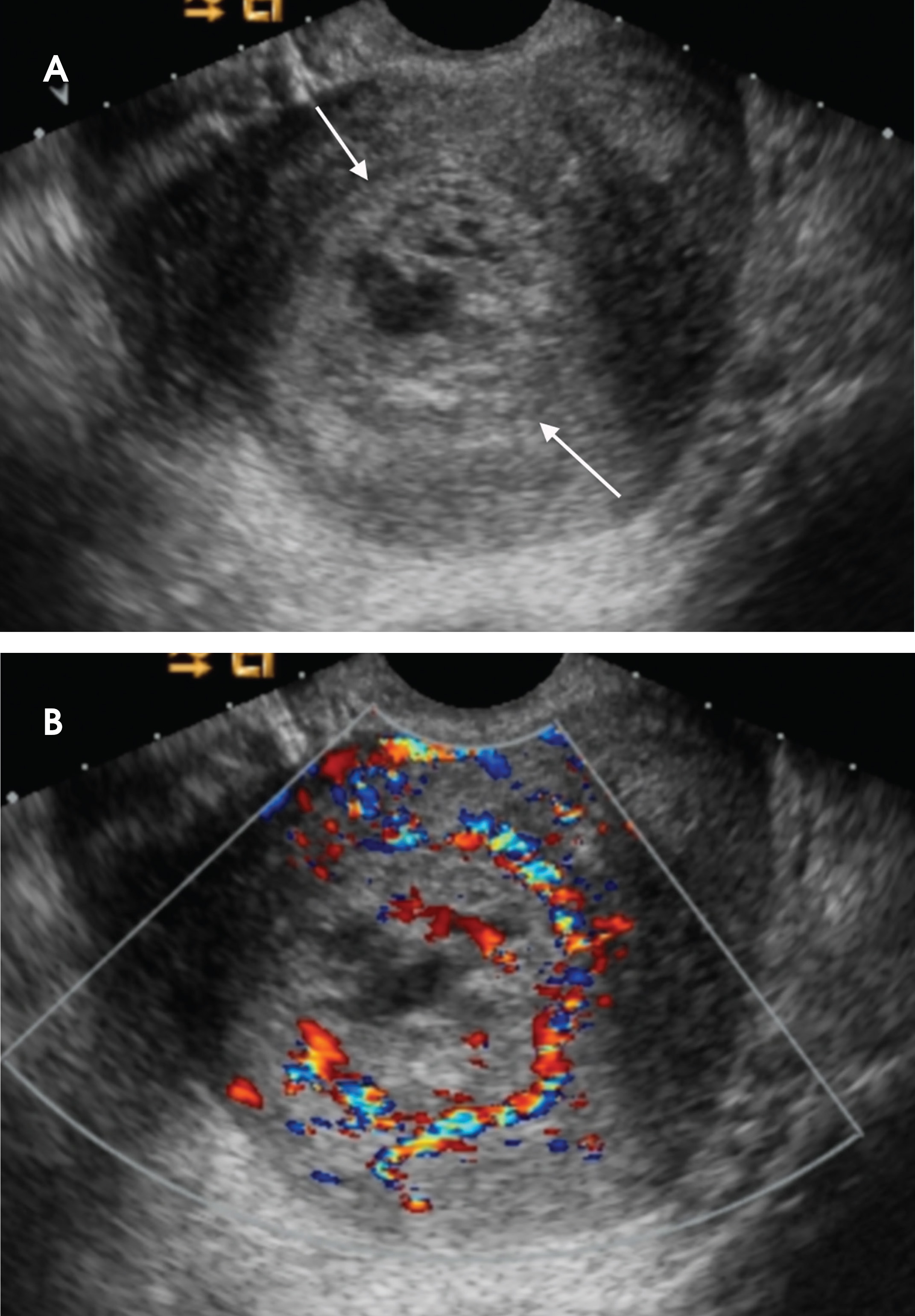 FIGURE 17.
