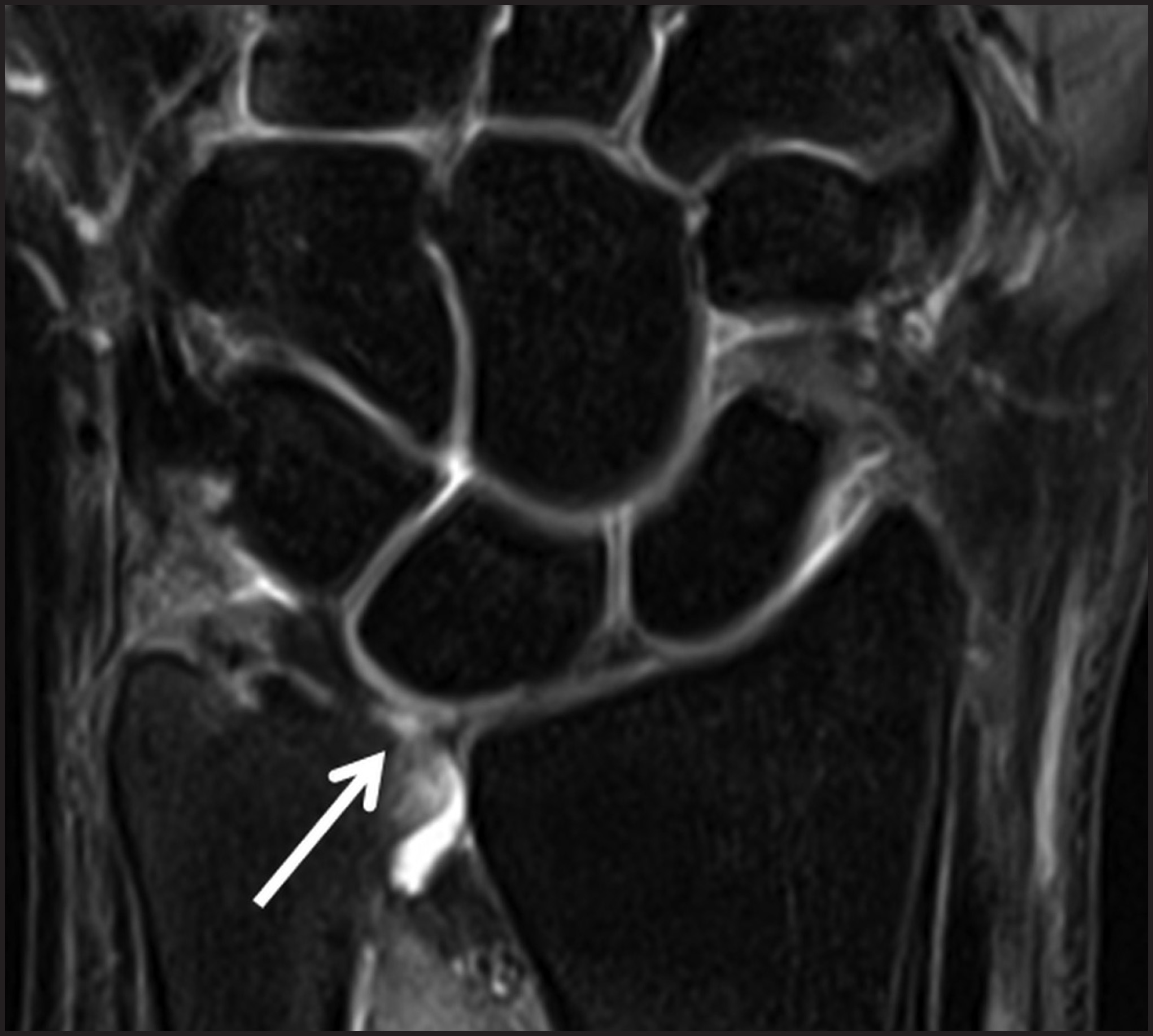 FIGURE 9.