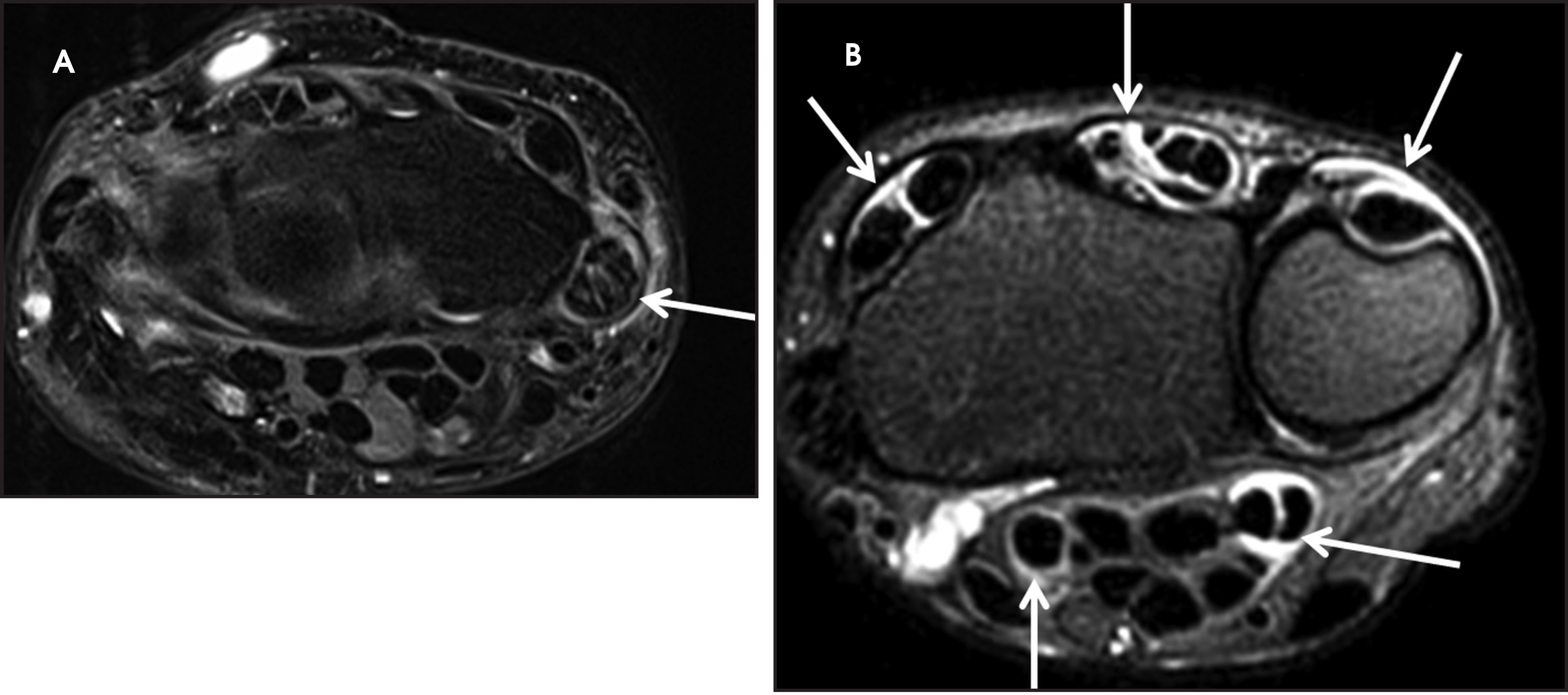 FIGURE 11.