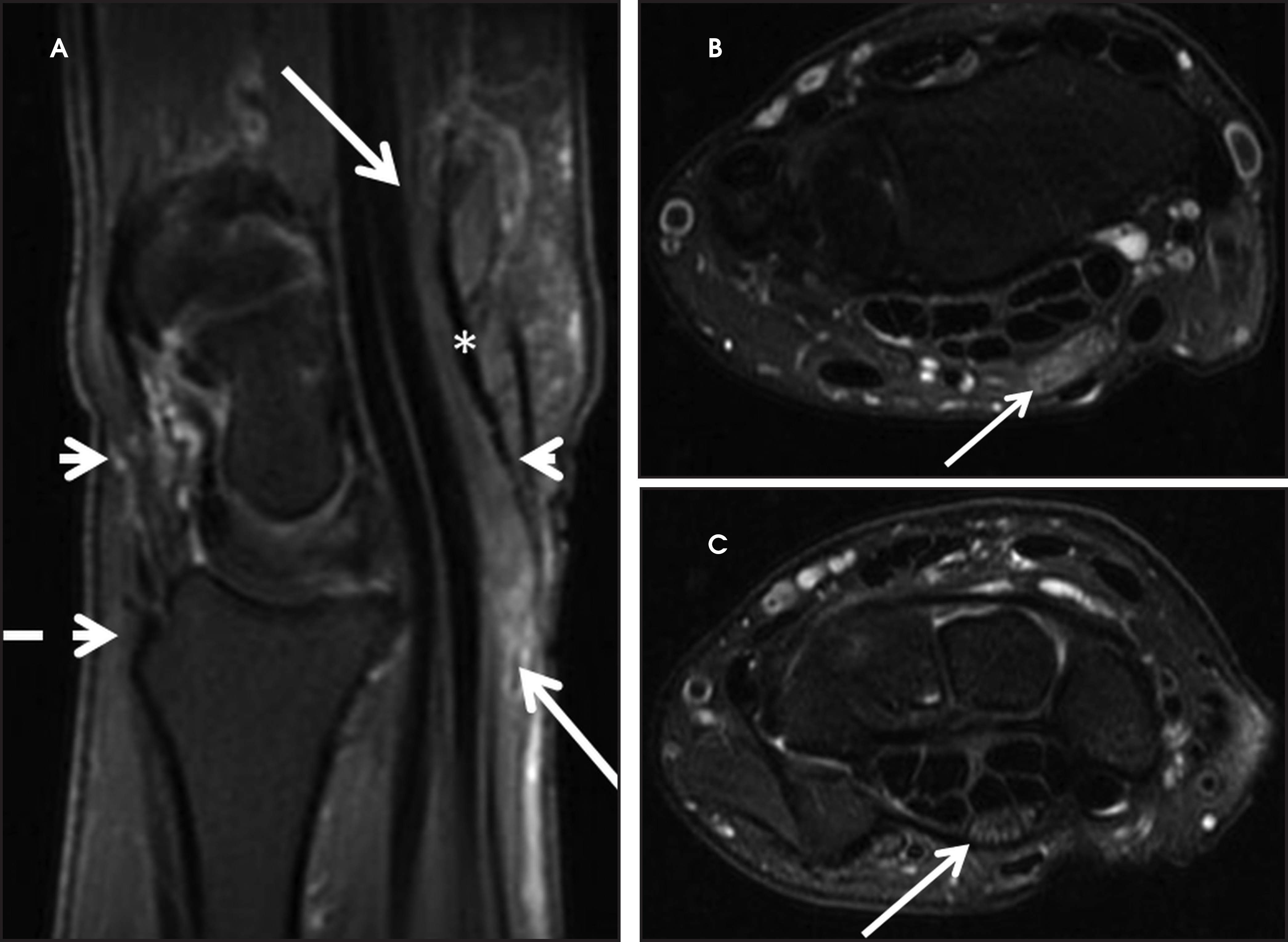 FIGURE 13.