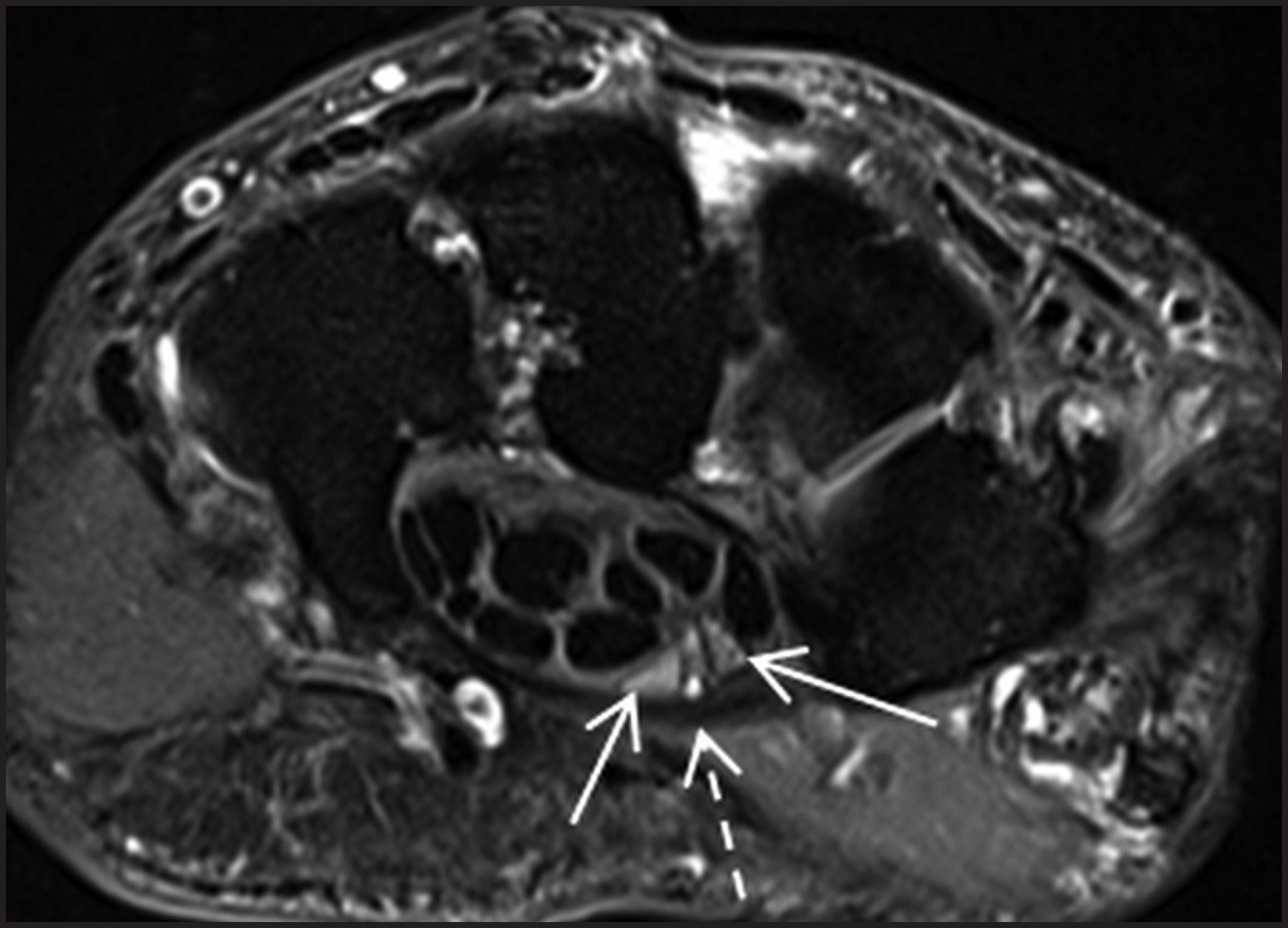 FIGURE 14.