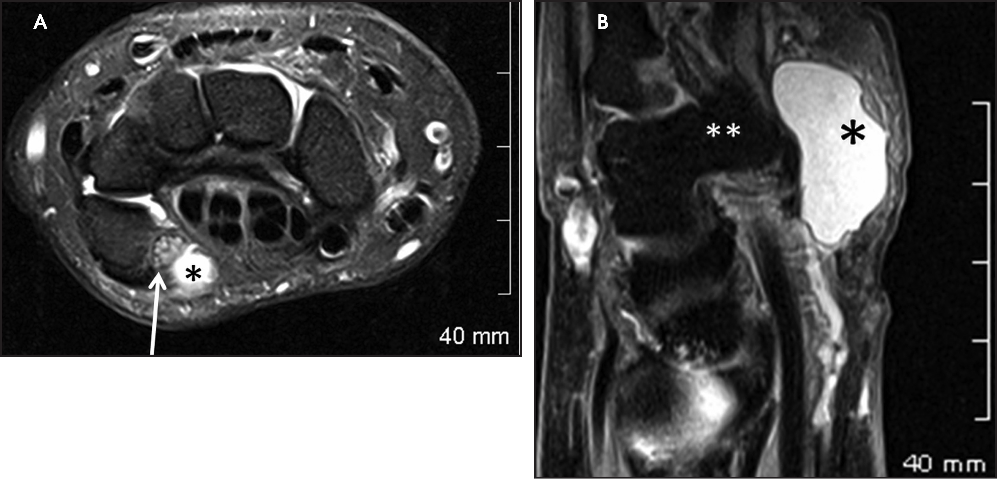 FIGURE 16.