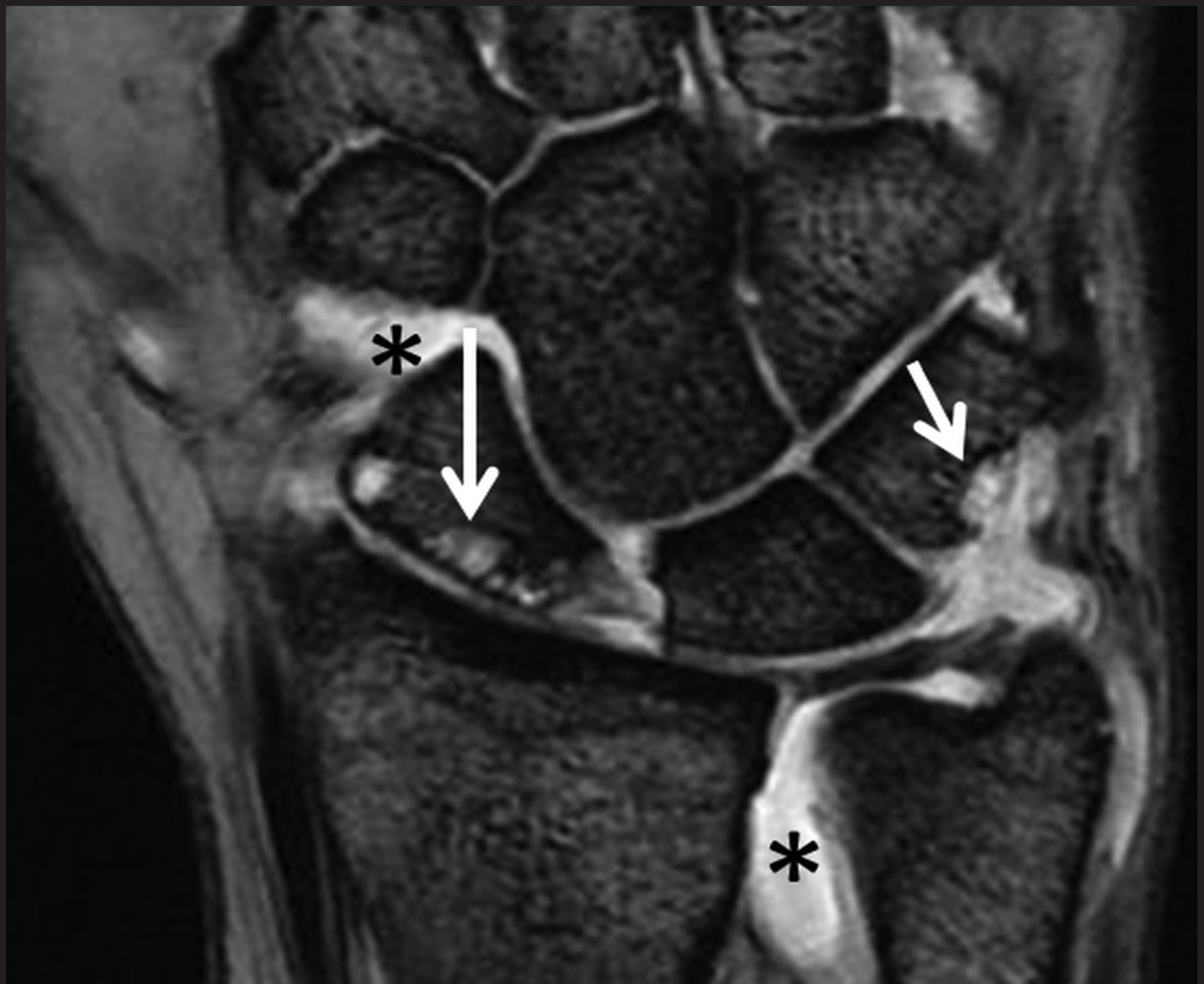 FIGURE 17.