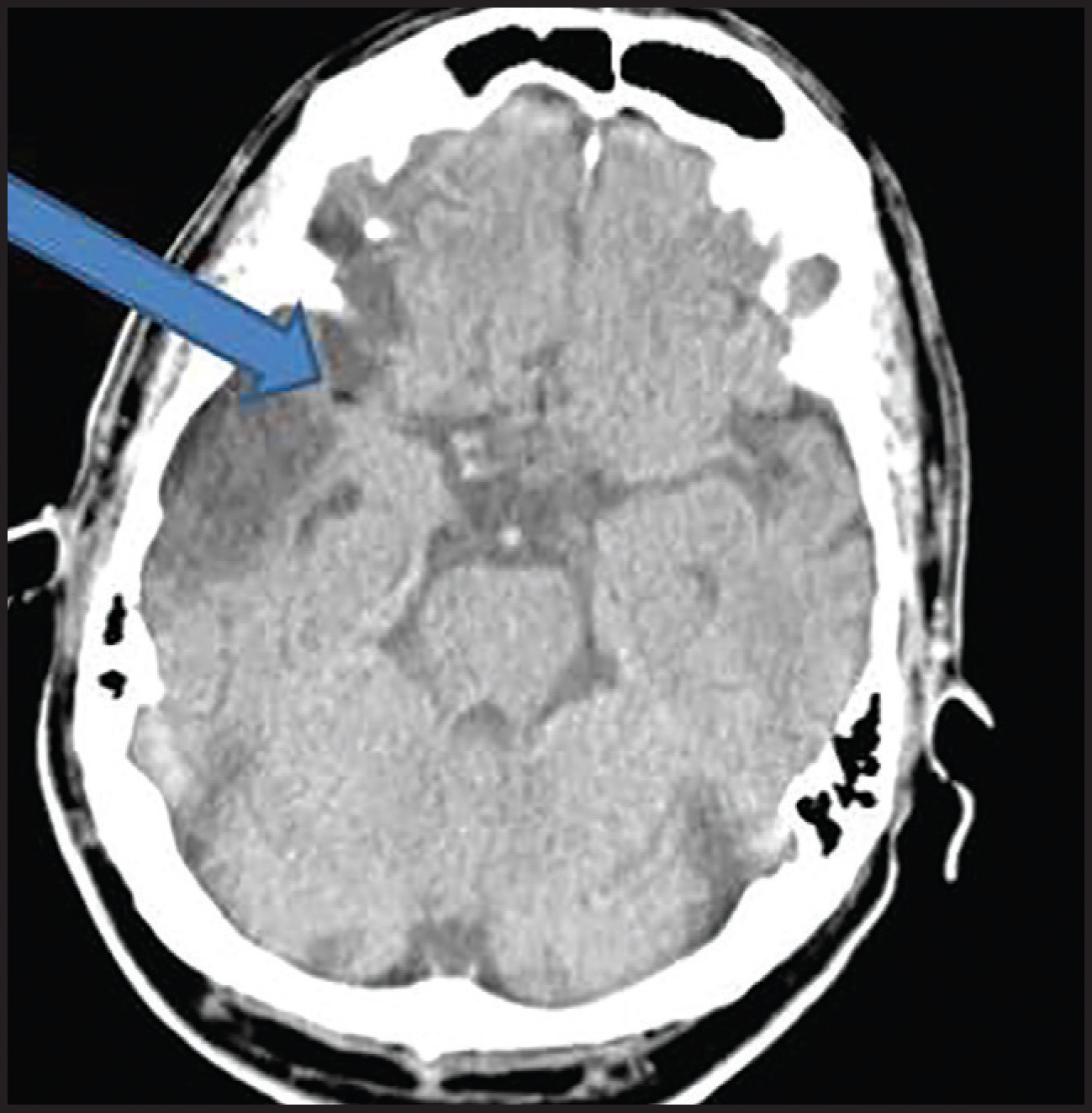 FIGURE 3.