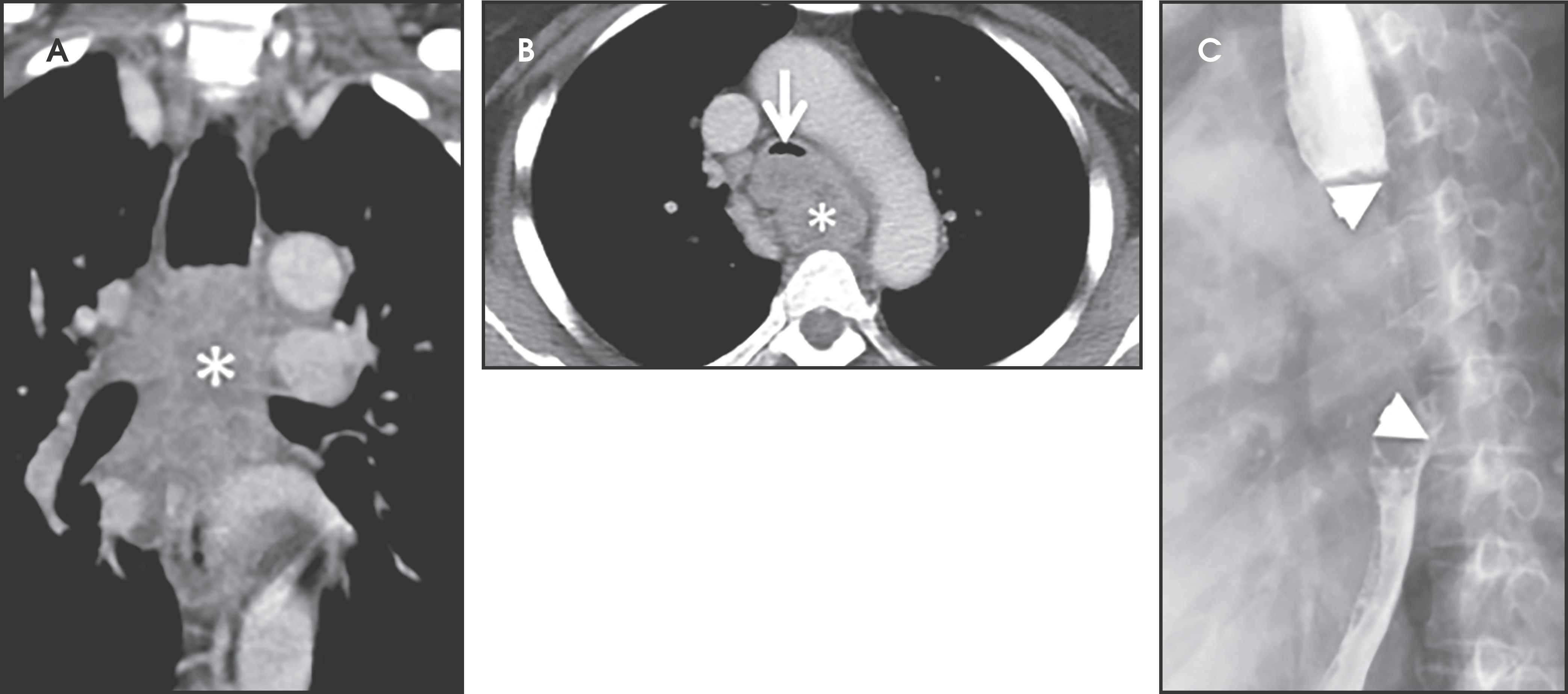 FIGURE 11.