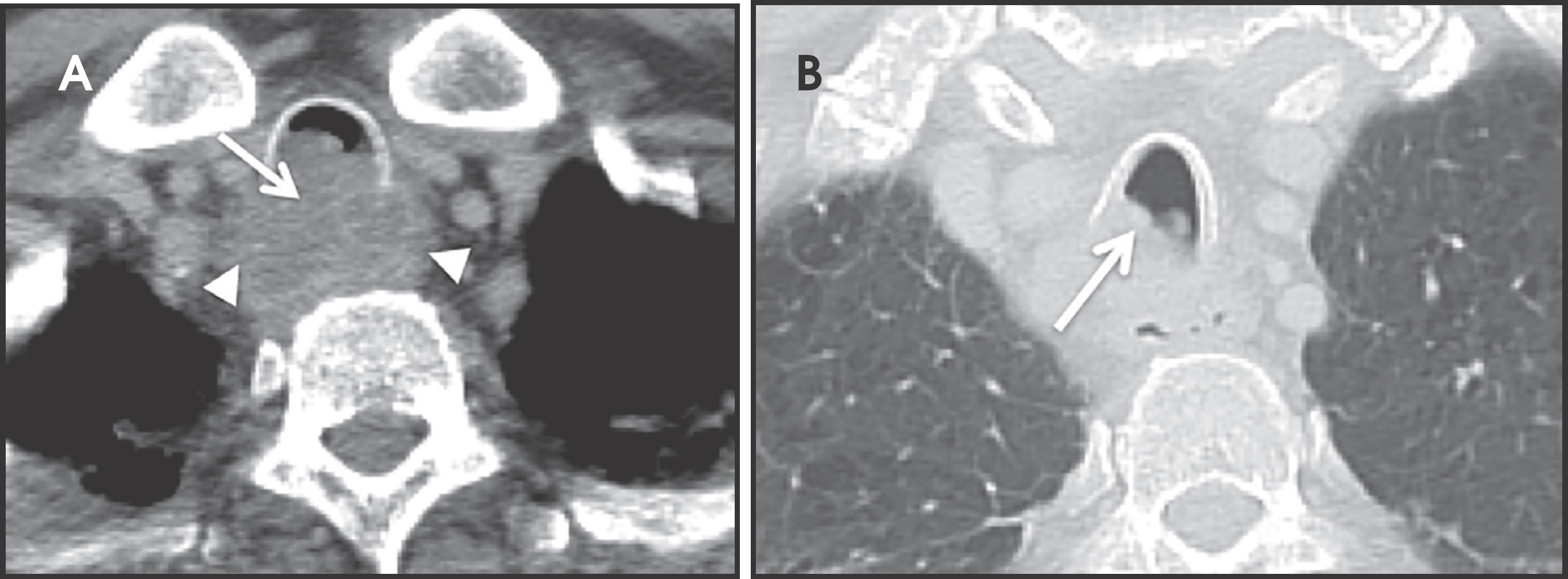 FIGURE 12.
