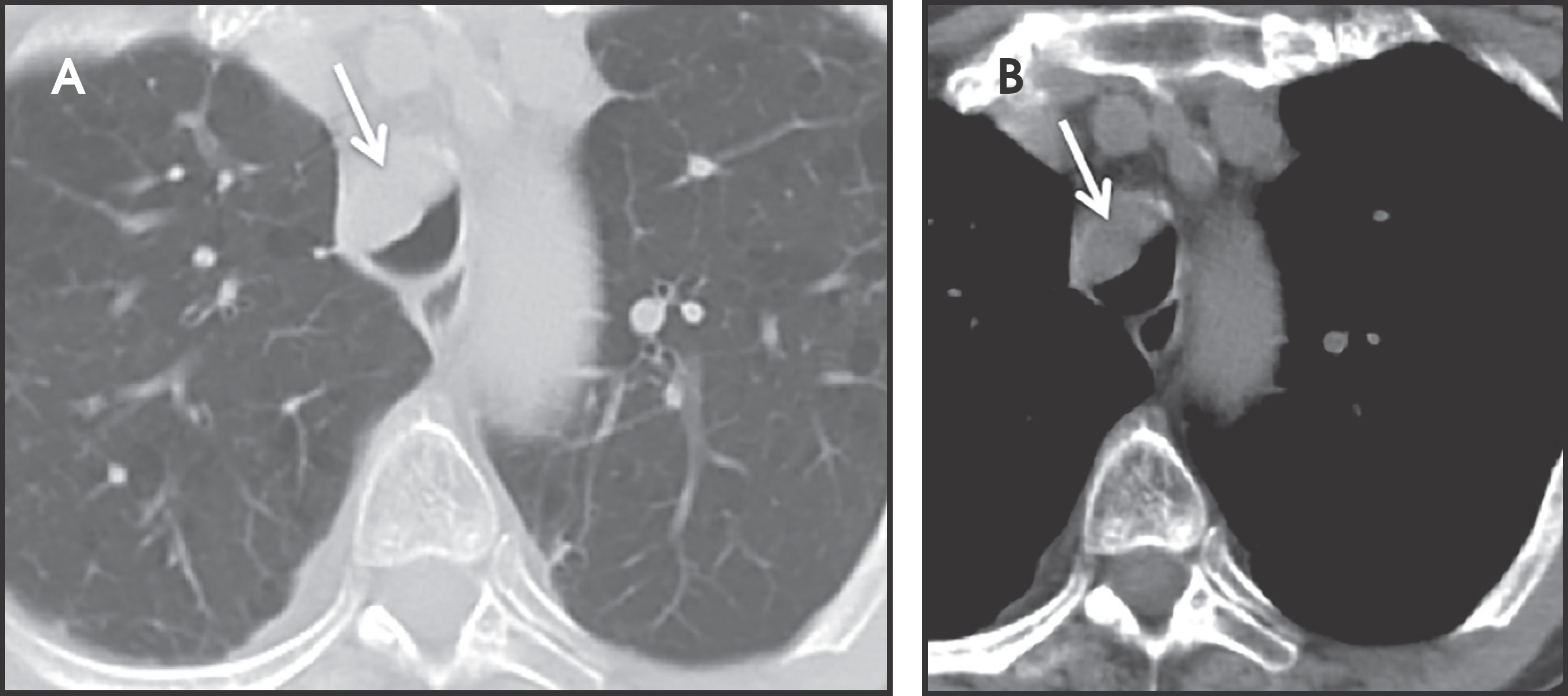 FIGURE 13.