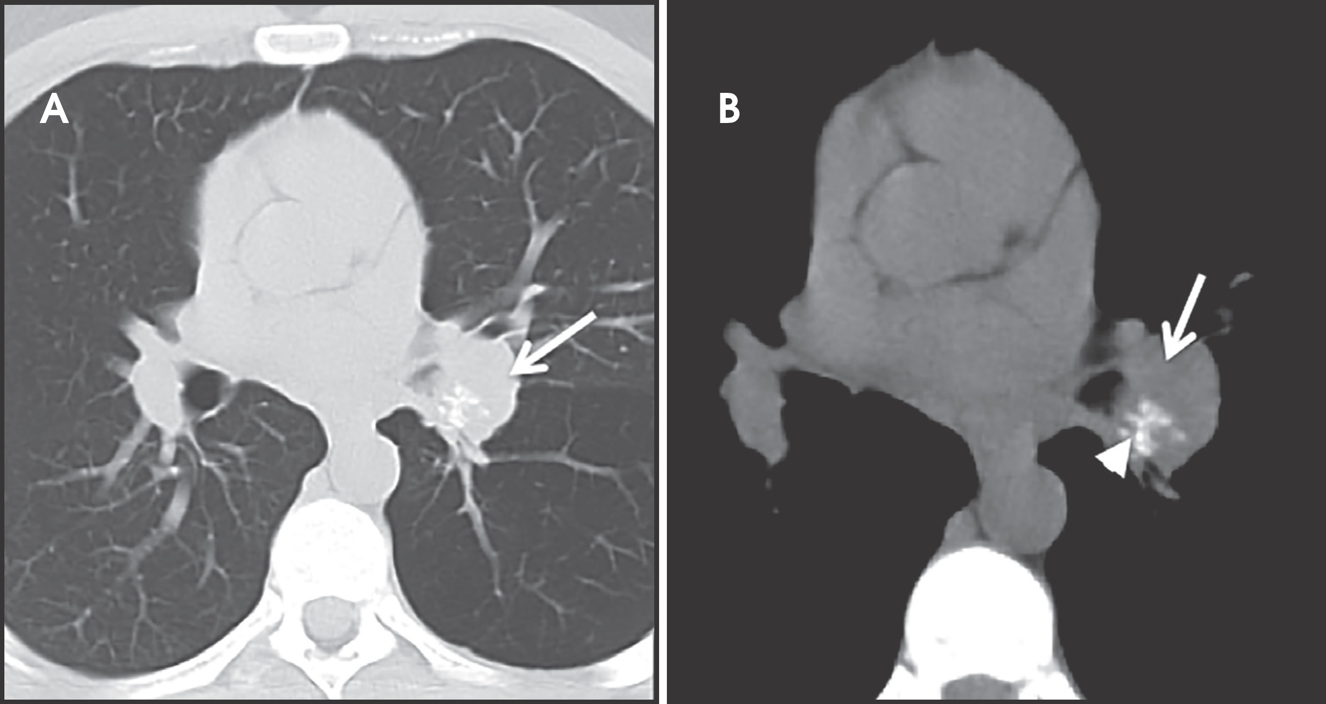 FIGURE 14.
