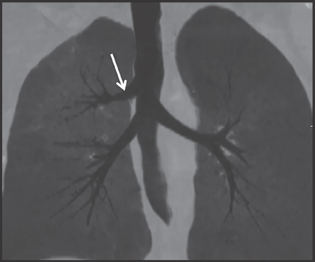 FIGURE 15.