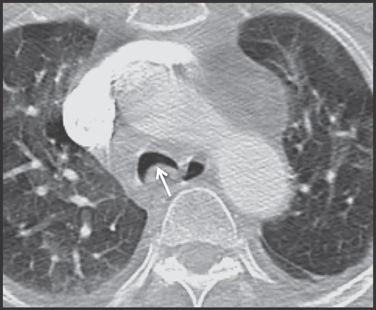 FIGURE 16.