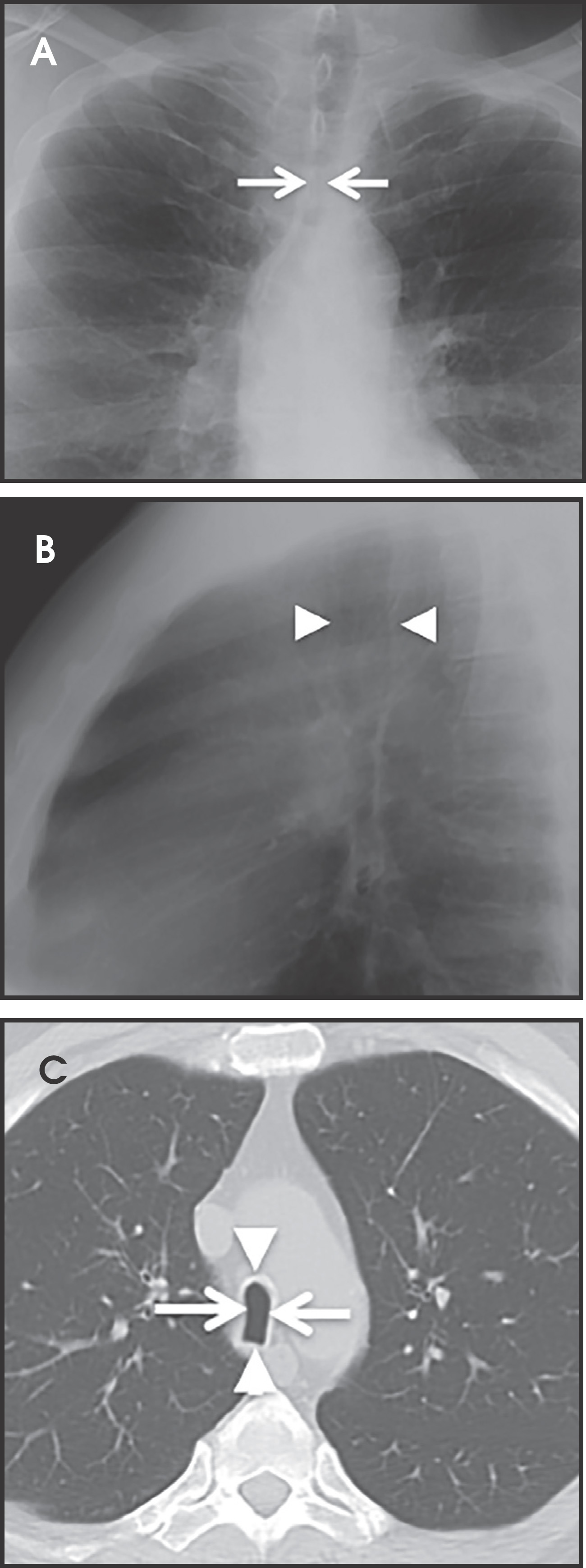 FIGURE 17.