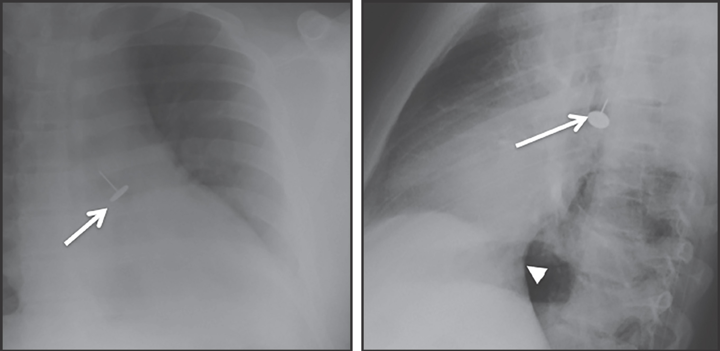 FIGURE 18.