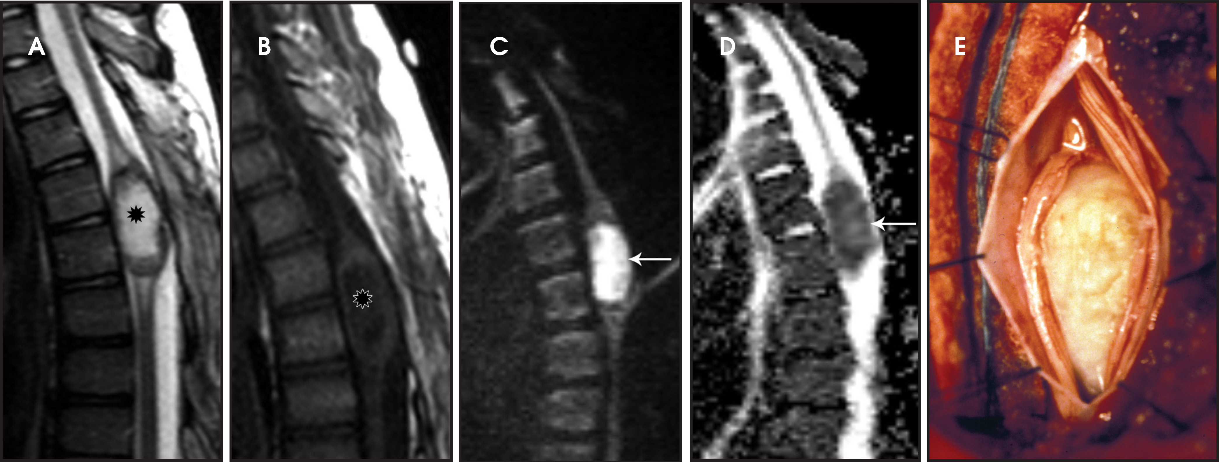 FIGURE 14.