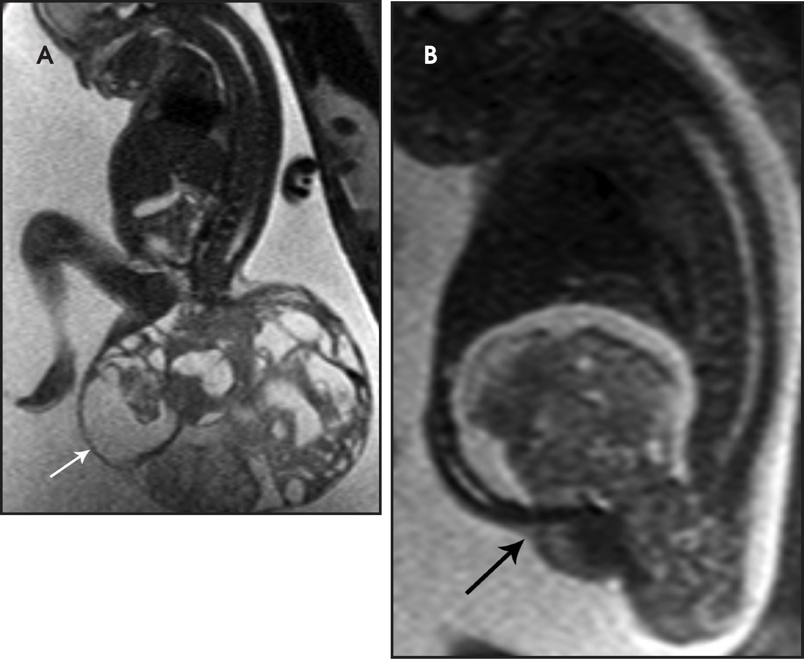 FIGURE 17.