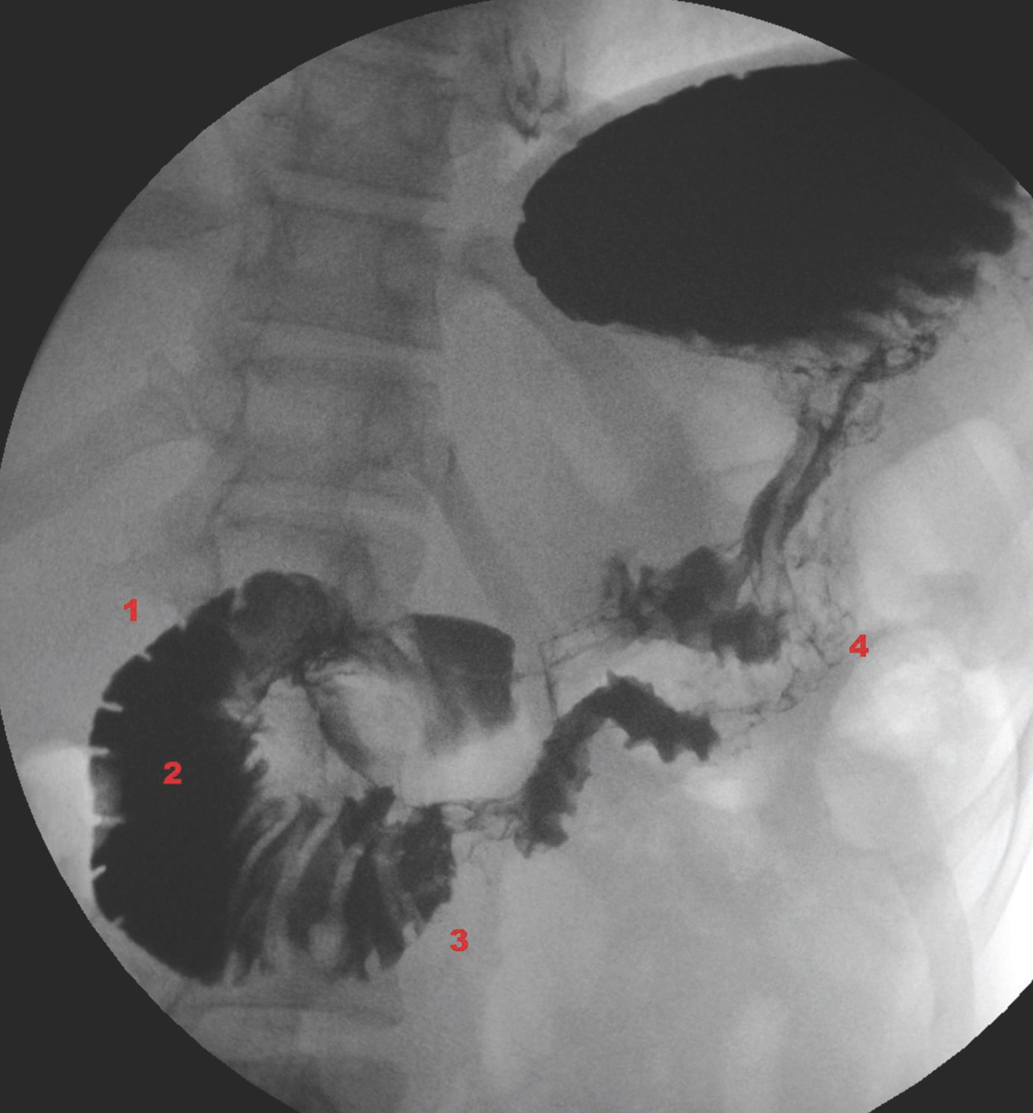 FIGURE 4.