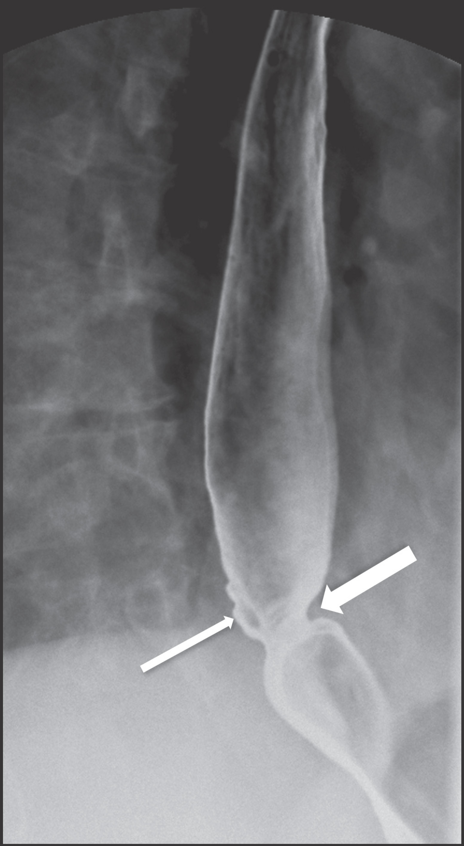 FIGURE 11.