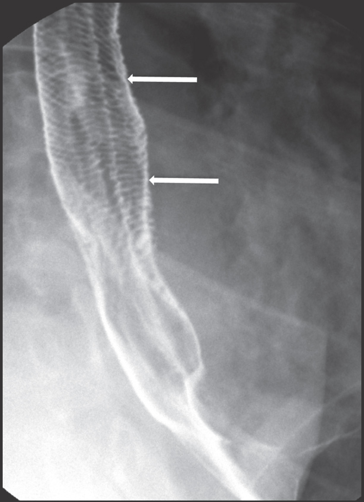 FIGURE 13.