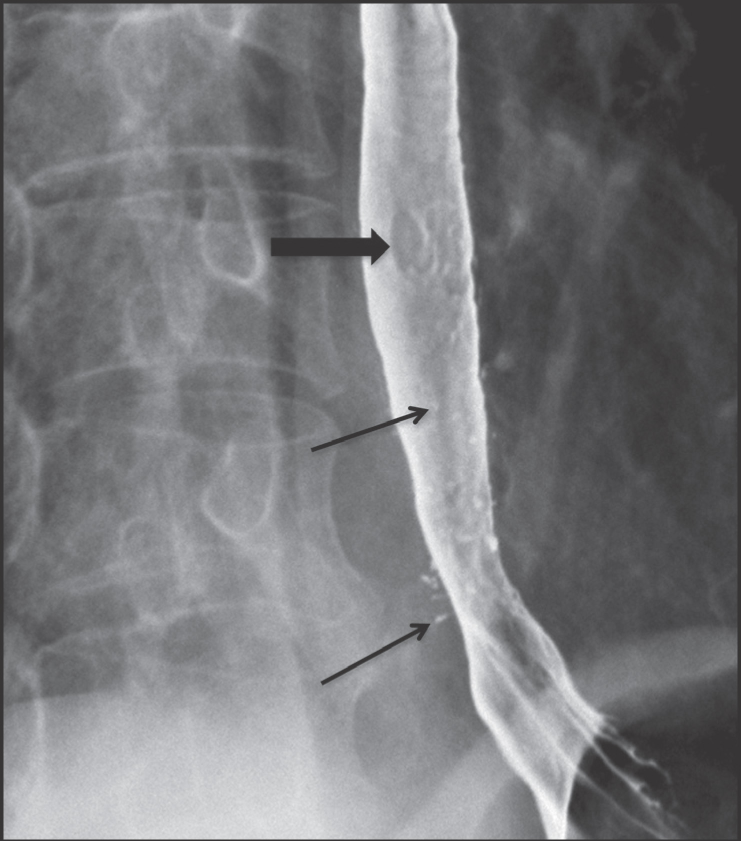 FIGURE 14.