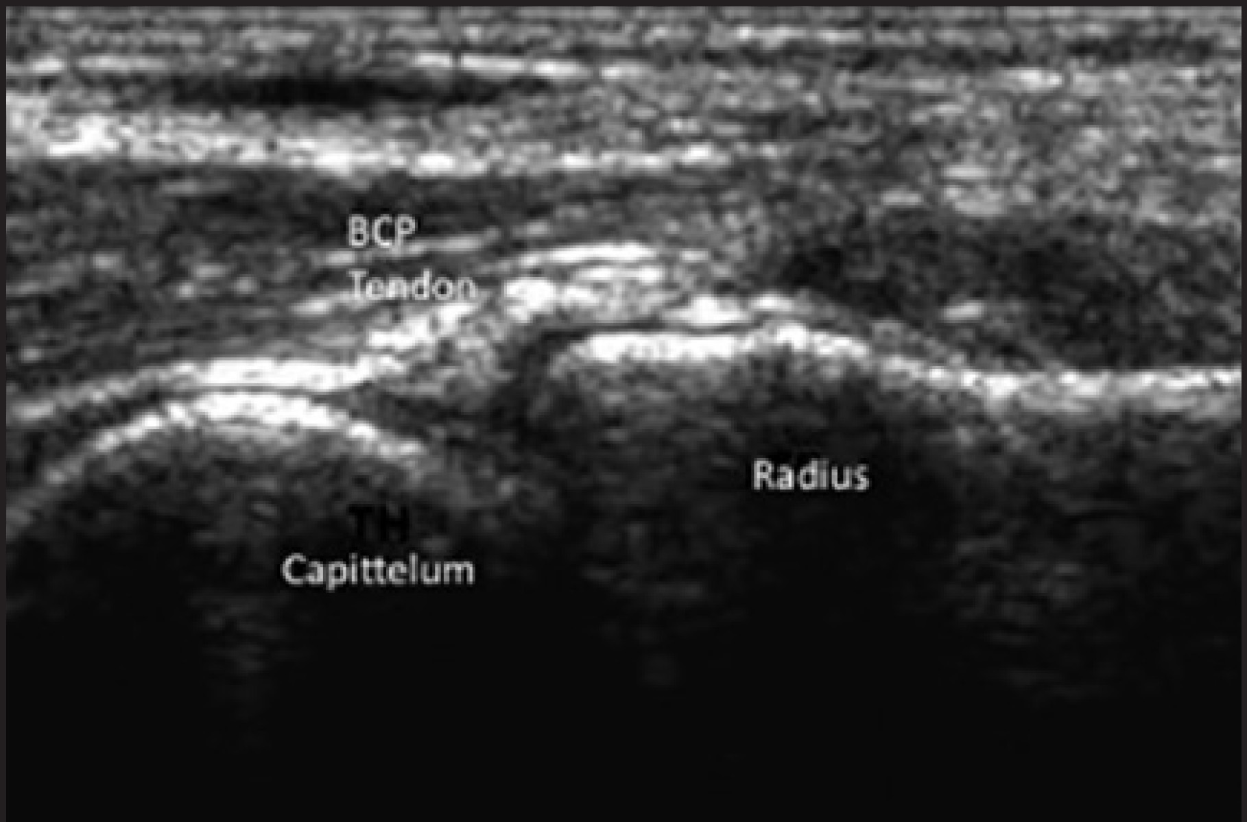 FIGURE 11.