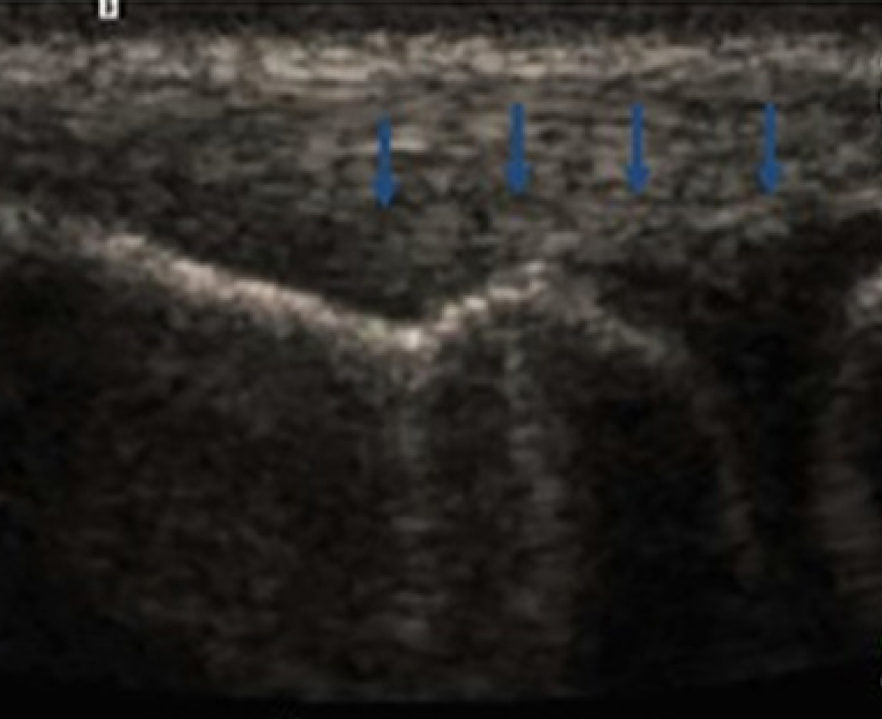 Figure 13.