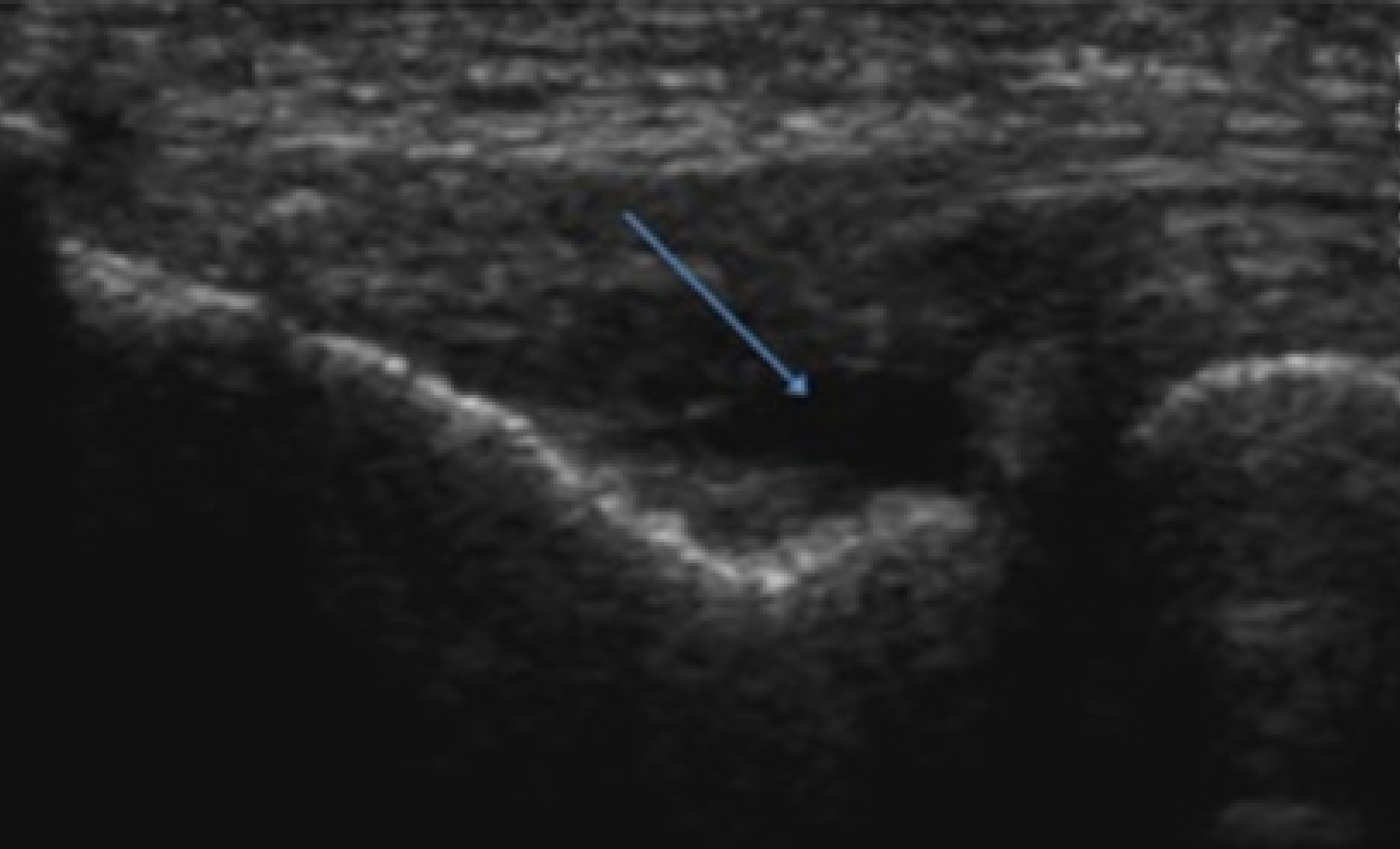 FIGURE 14.