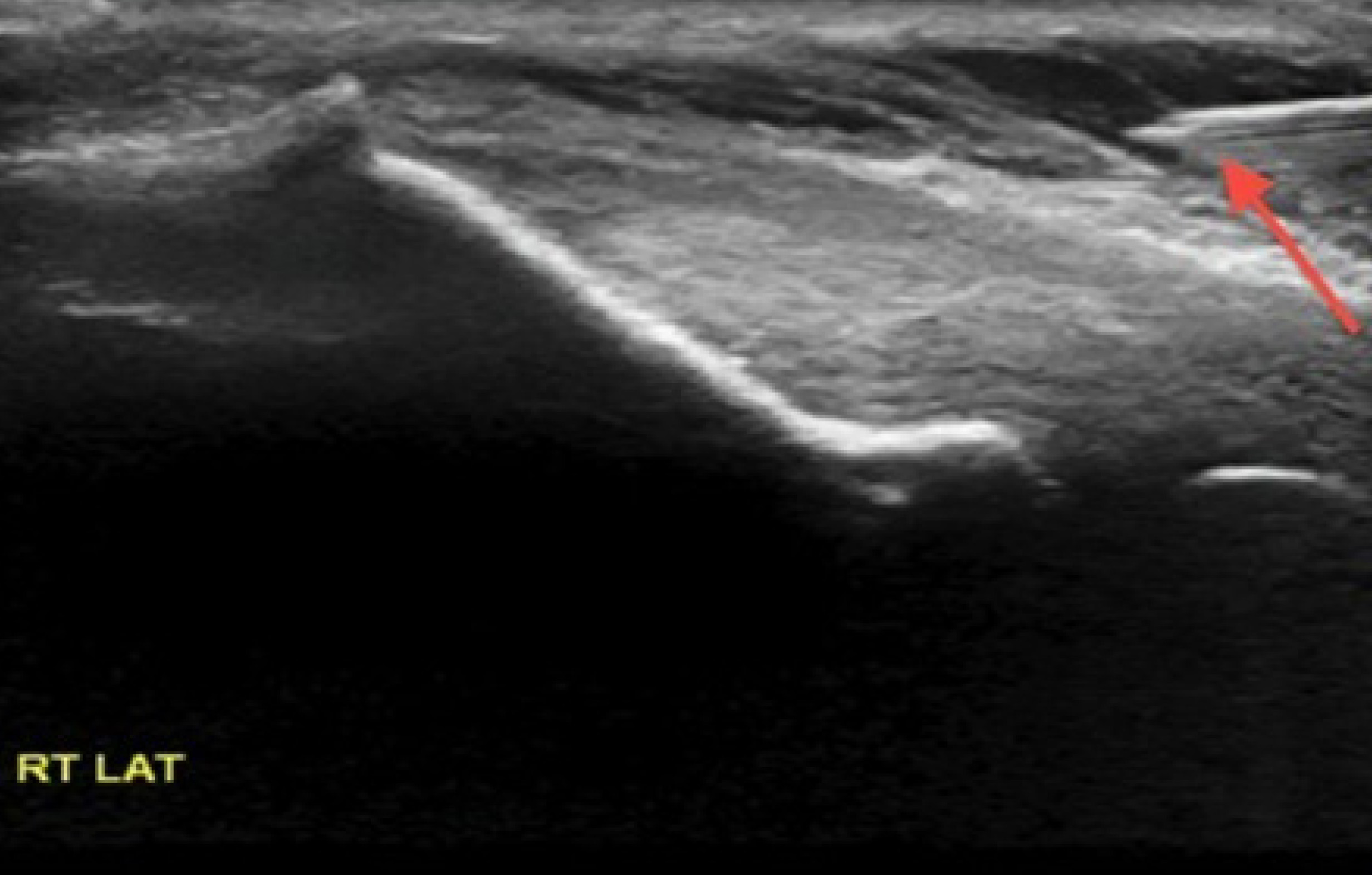 FIGURE 16.
