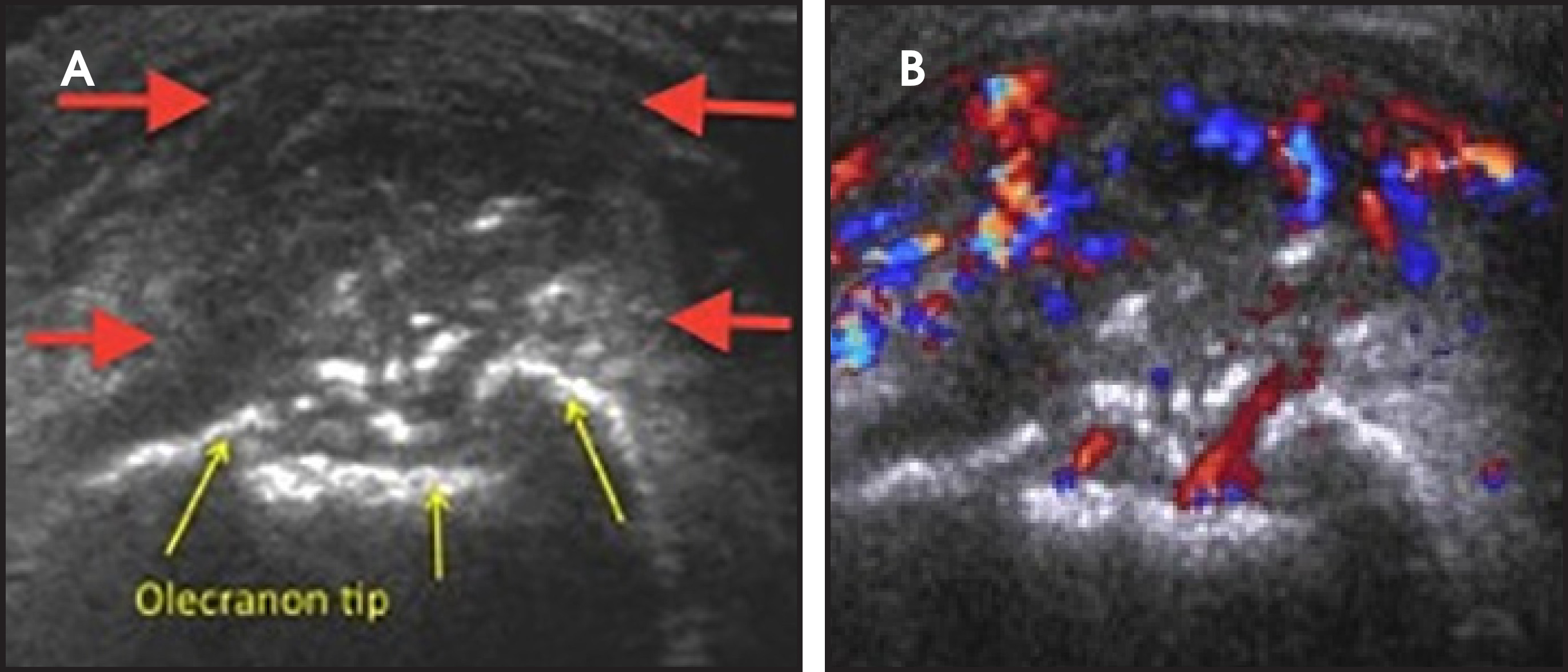 FIGURE 18.