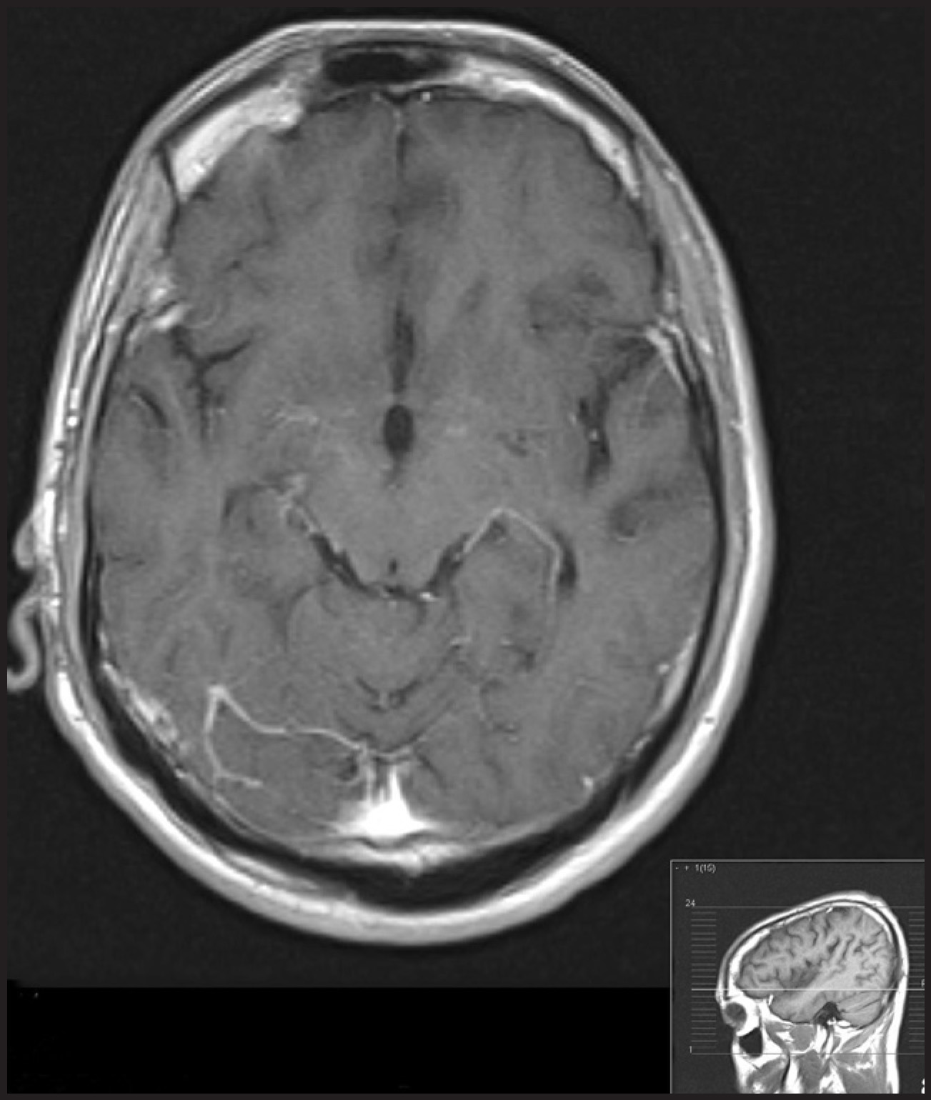FIGURE 1.