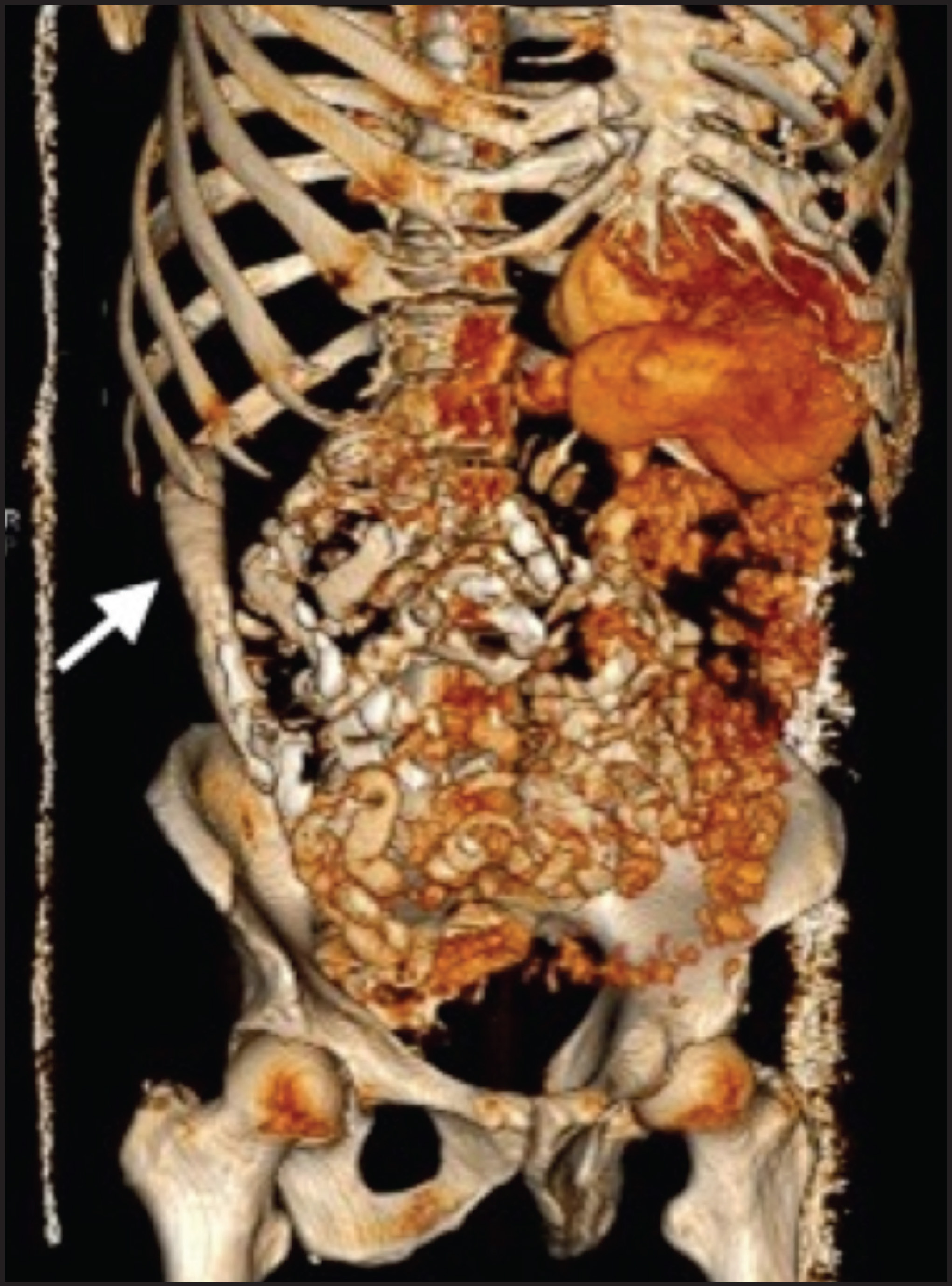 FIGURE 3.
