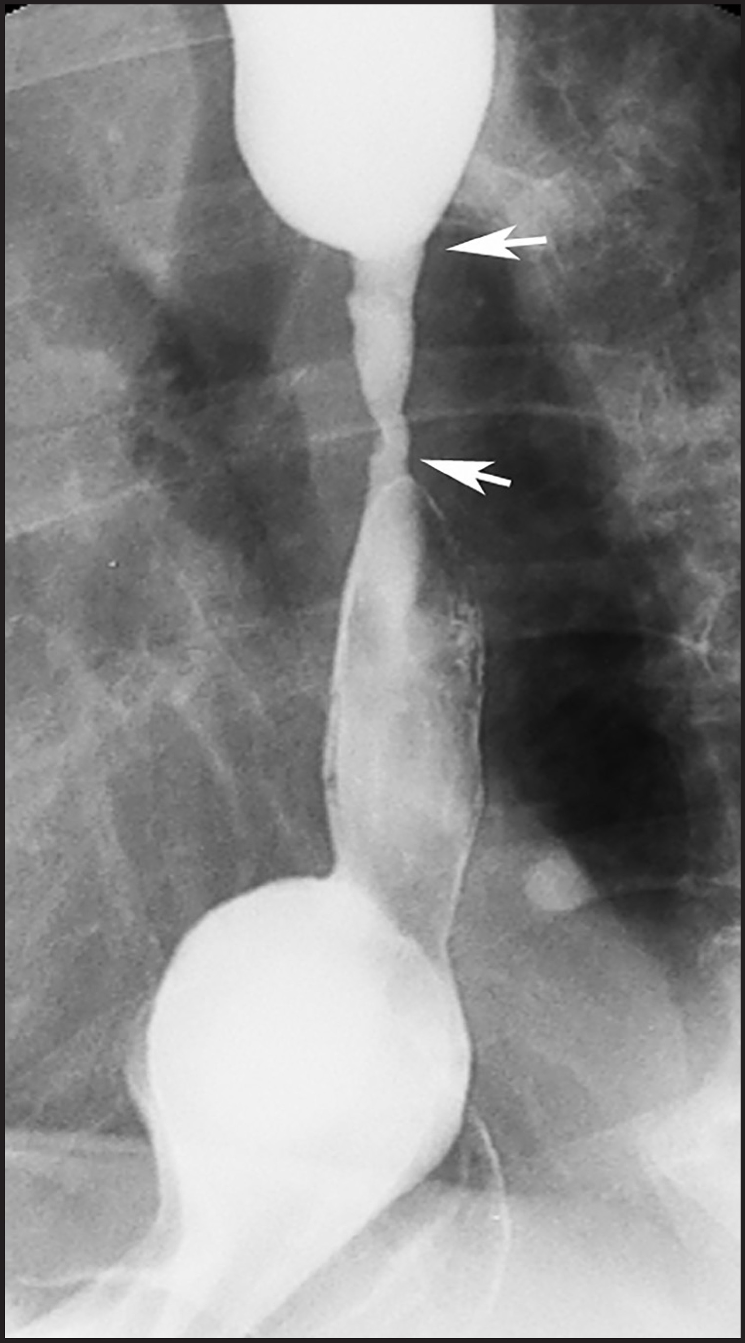FIGURE 11.