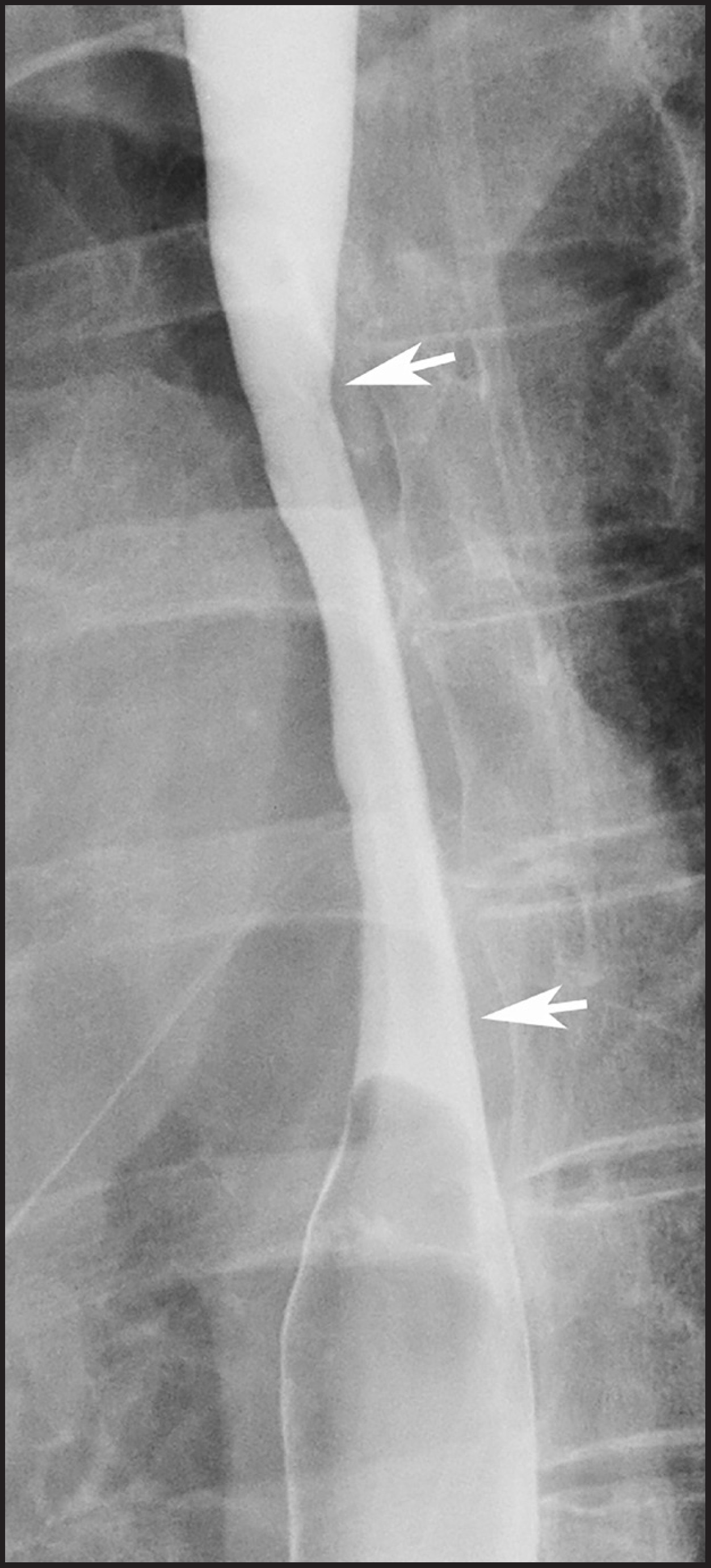 FIGURE 12.