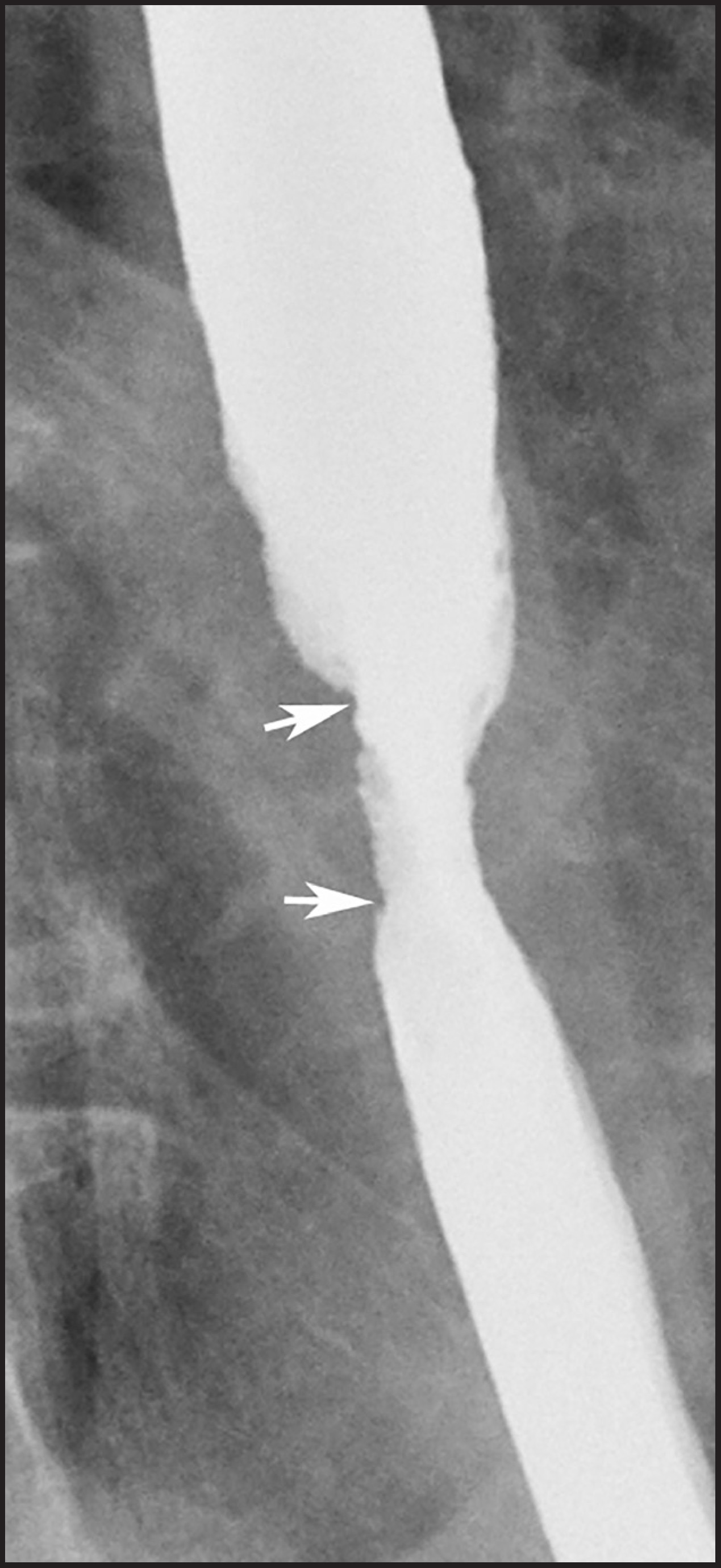 FIGURE 13.
