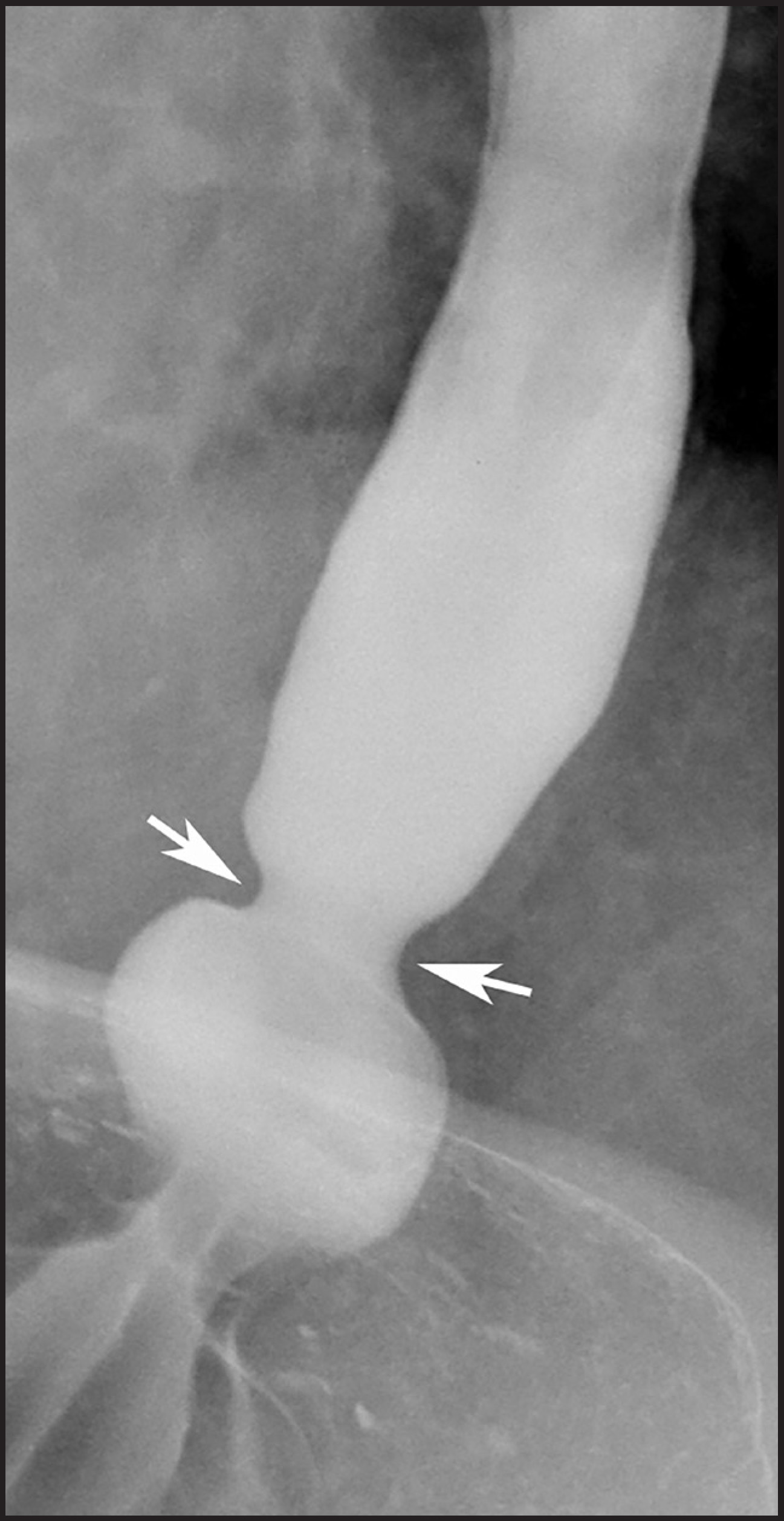 FIGURE 14.