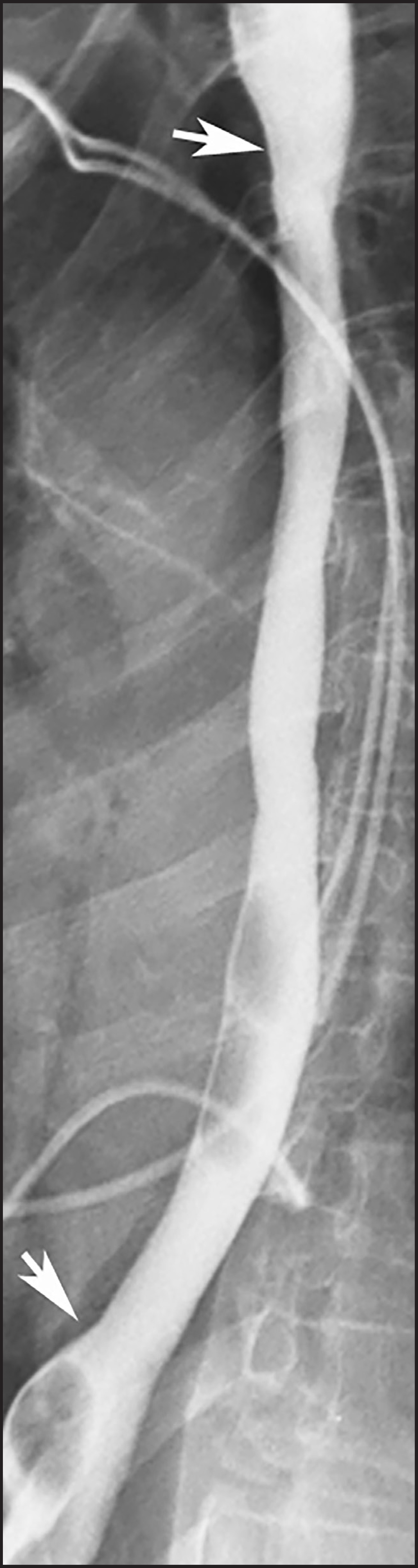 FIGURE 17.