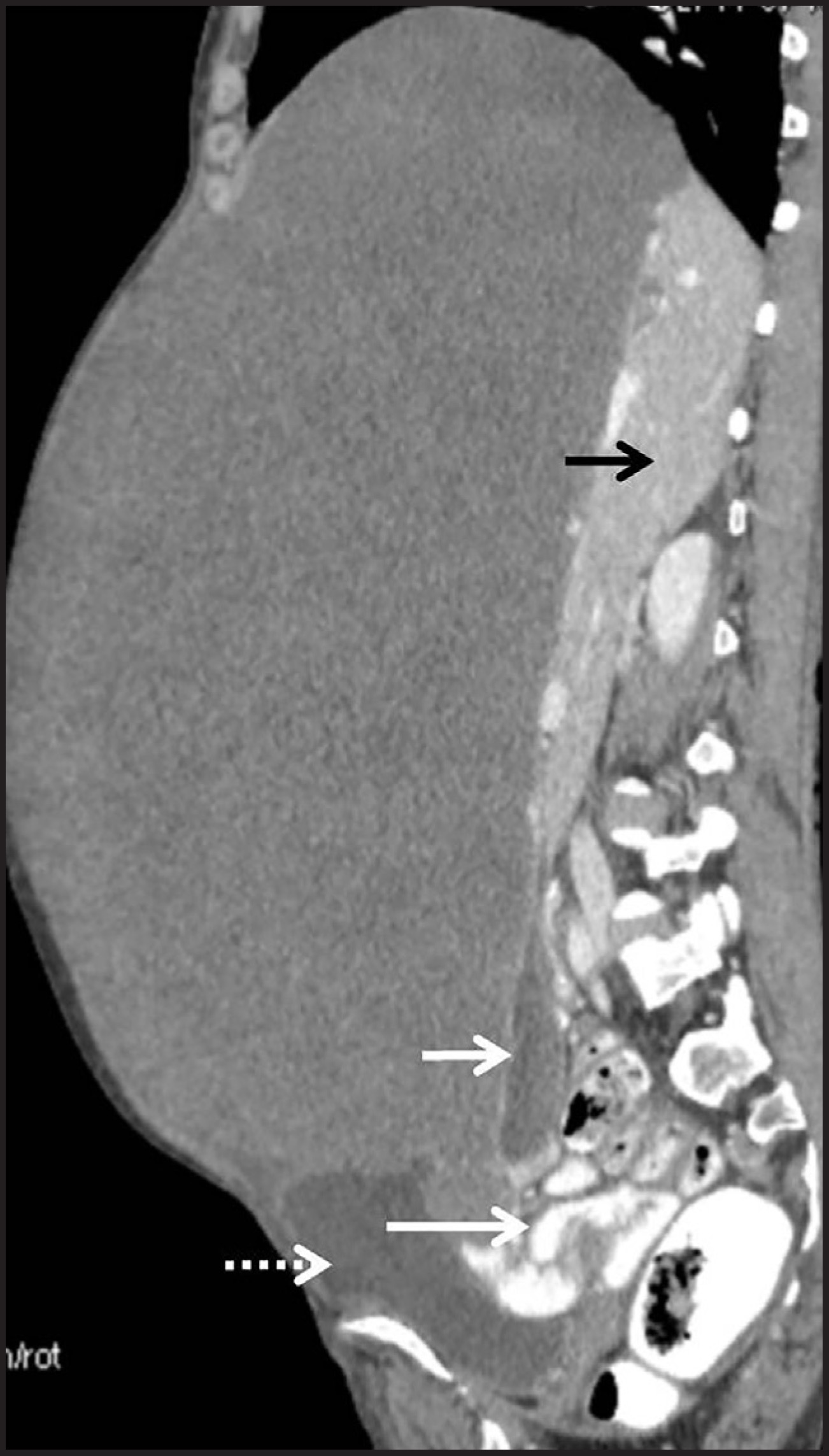 FIGURE 4.