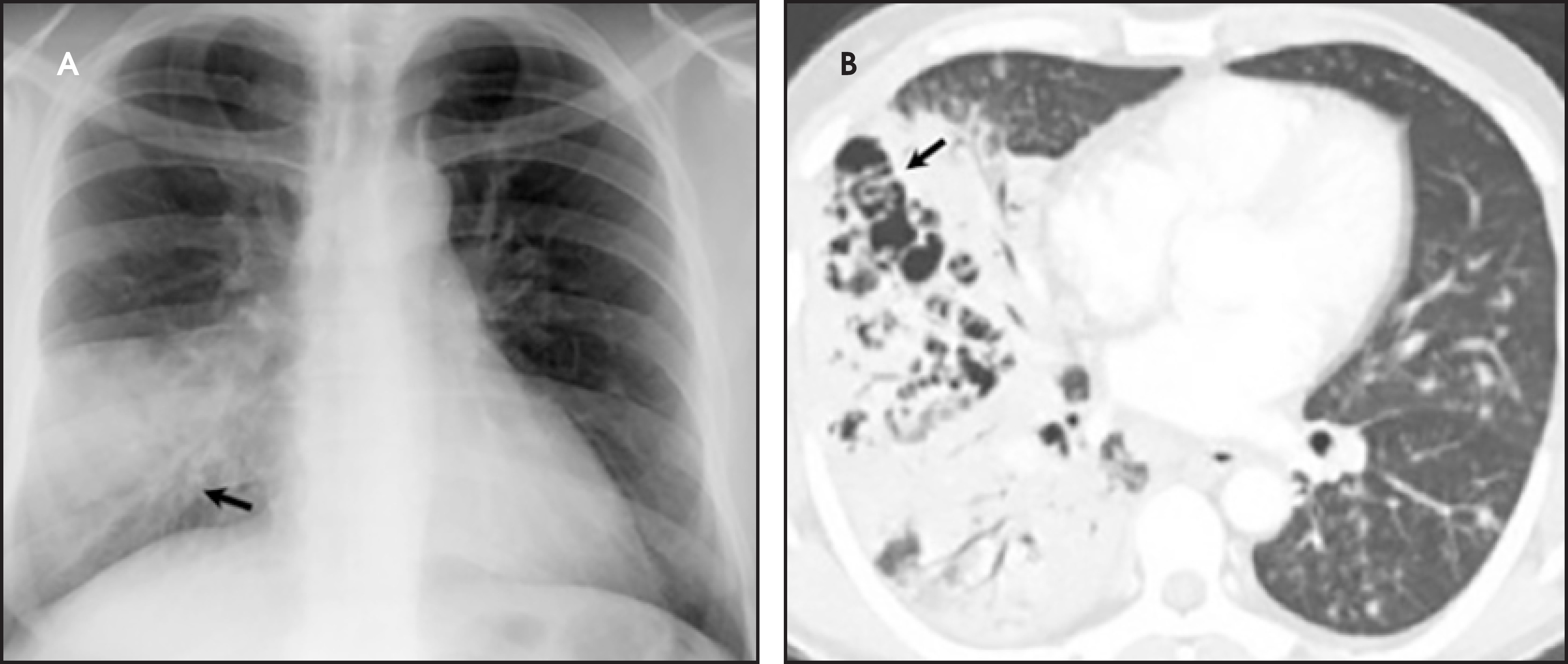 FIGURE 4.